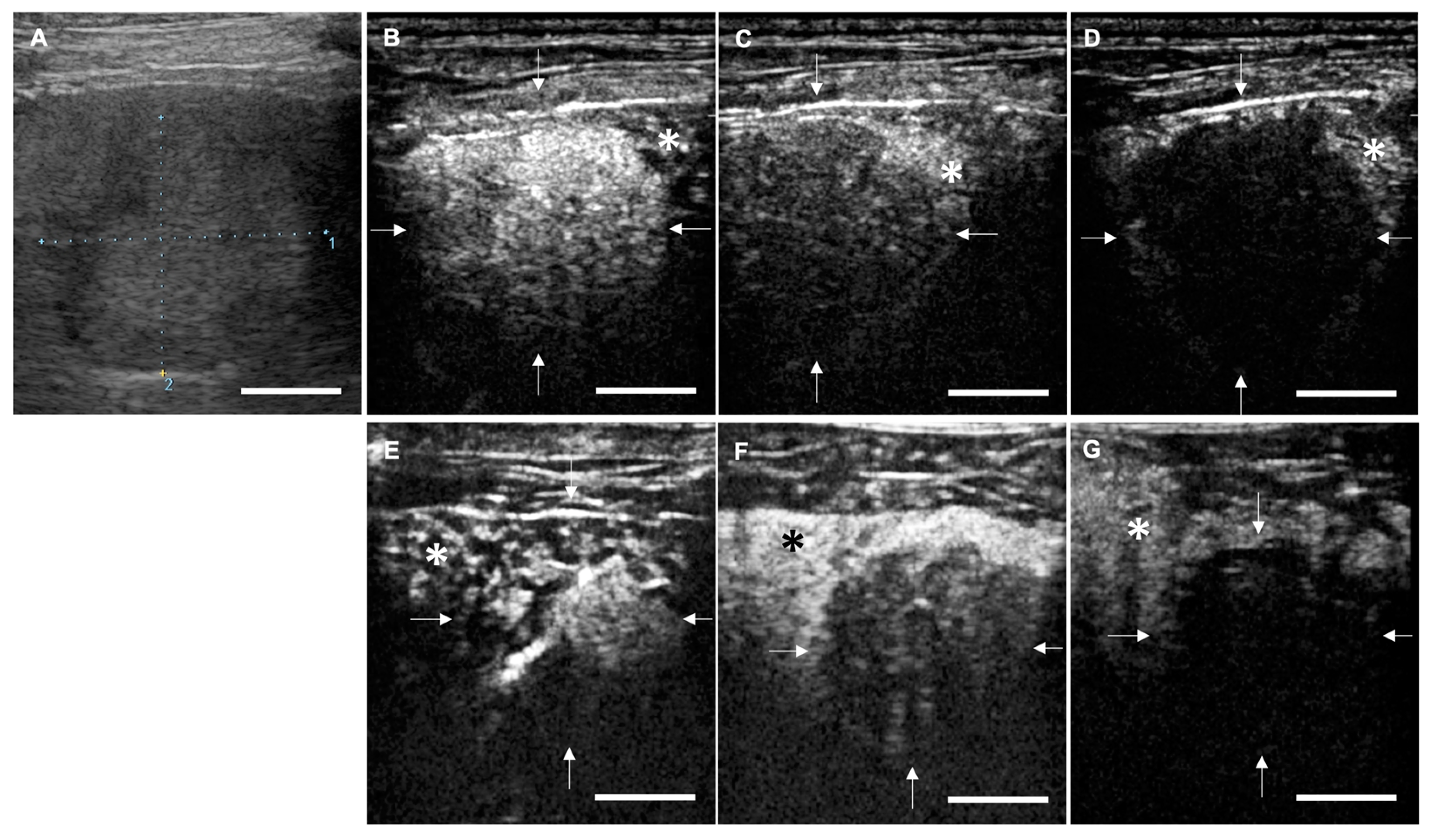 Cancers 12 02423 g004