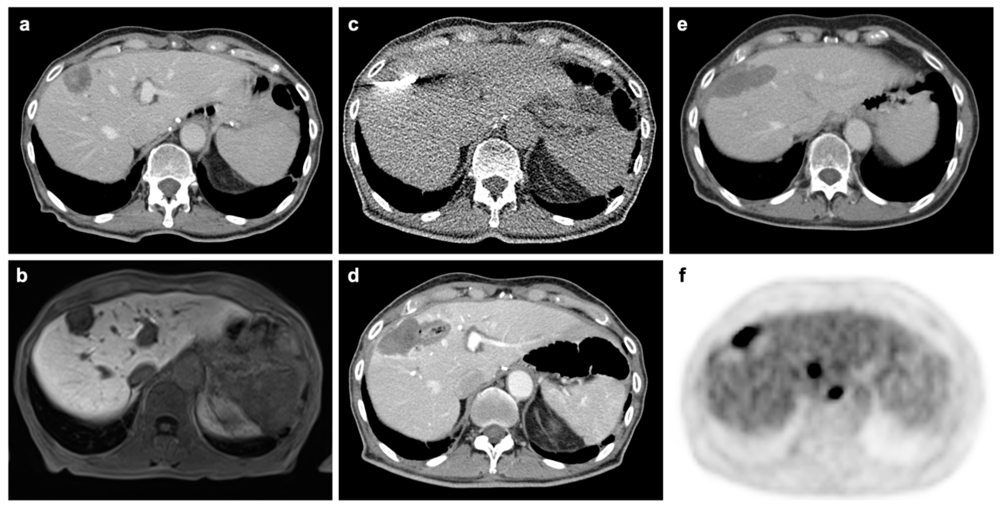 Cancers 12 02432 g004 Cancers 12 02432 g004