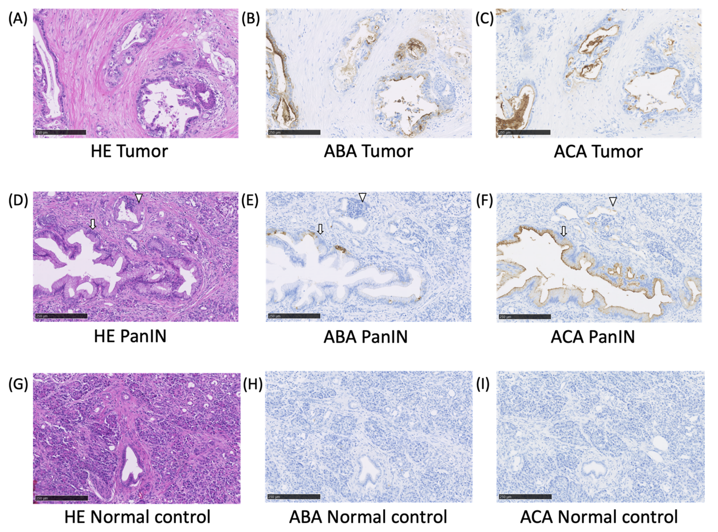 Cancers 12 02469 g003 Cancers 12 02469 g003