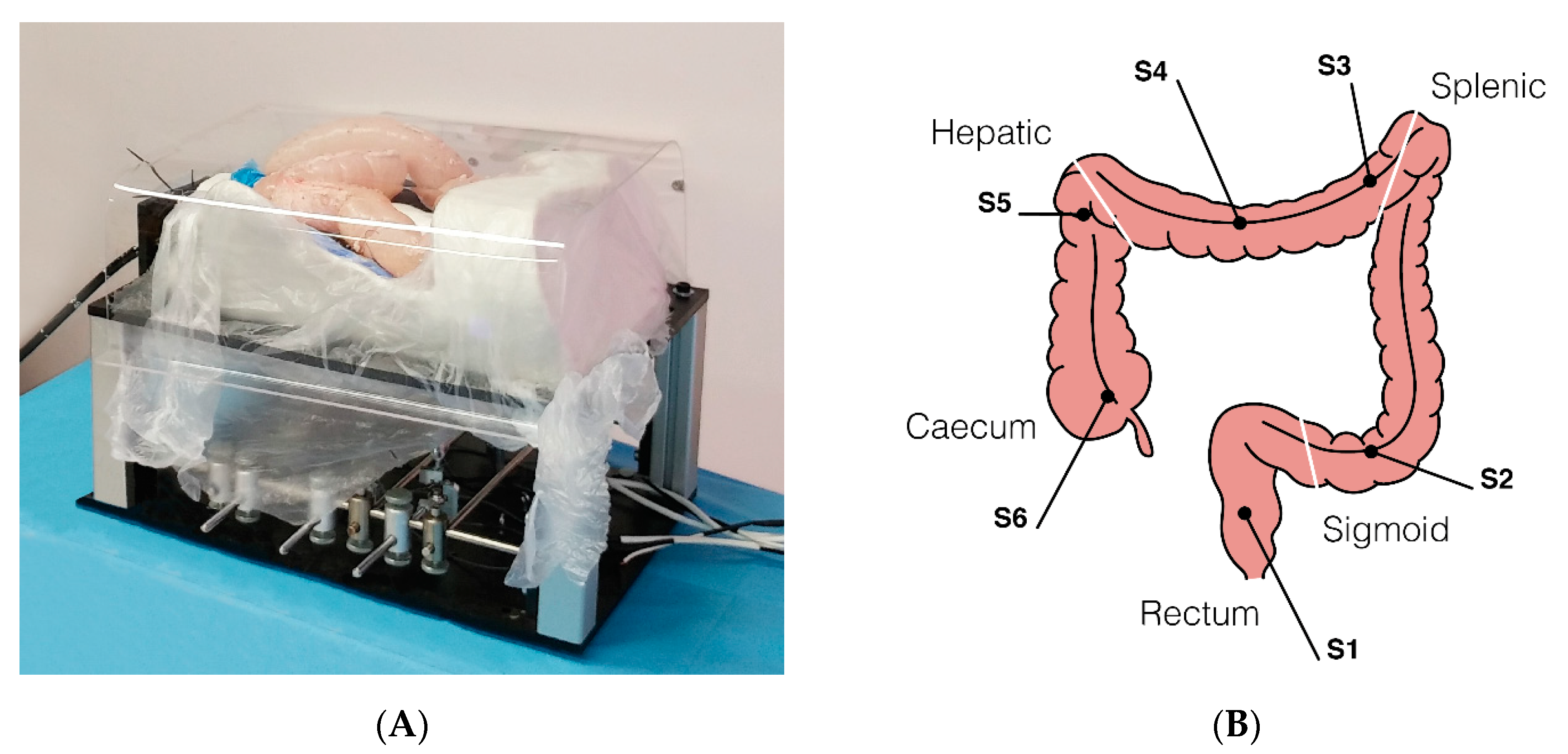 Cancers Free Full Text Robotic Assisted Colonoscopy Platform With A Magnetically Actuated Soft Tethered Capsule Html