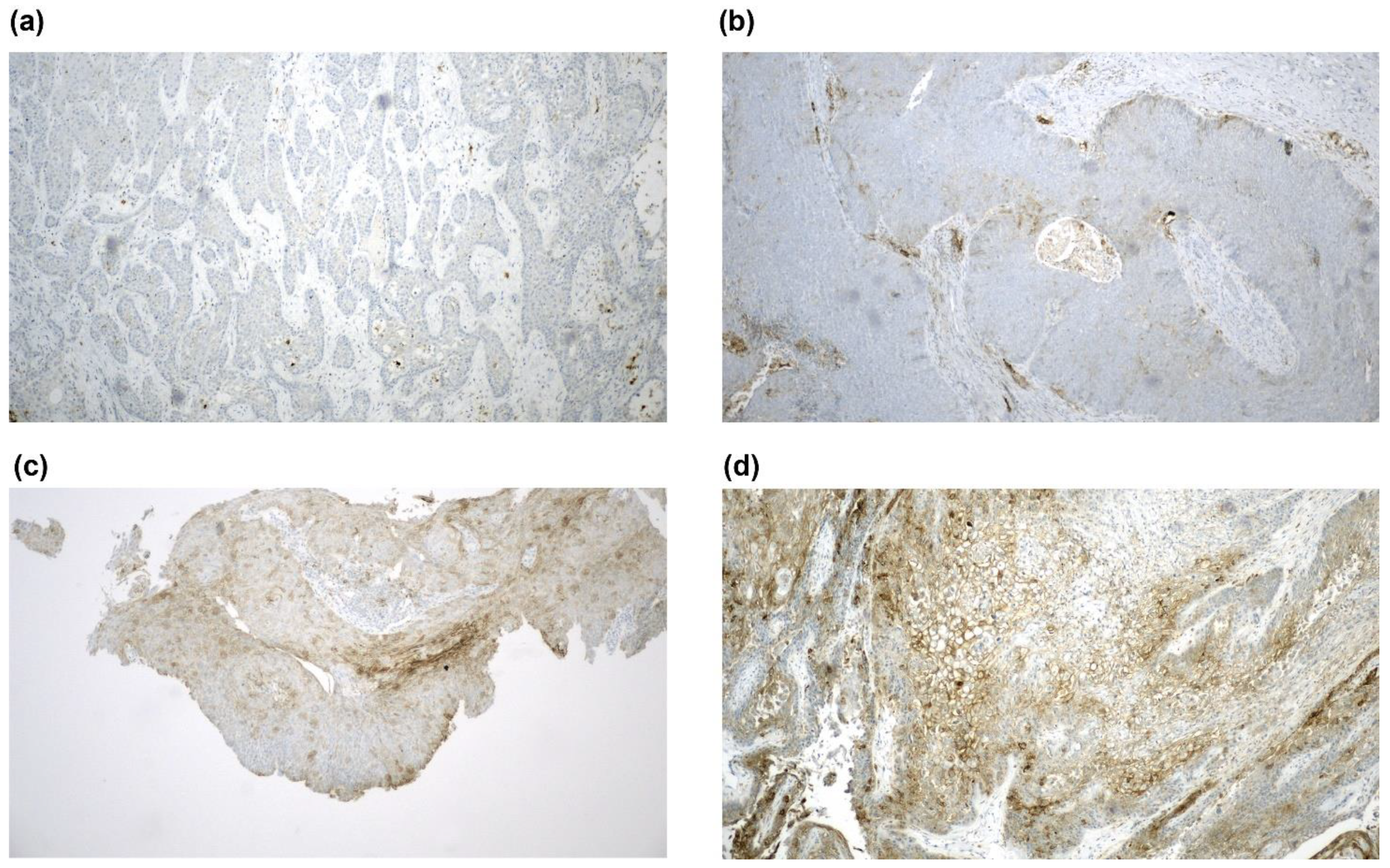 Cancers 12 02516 g003