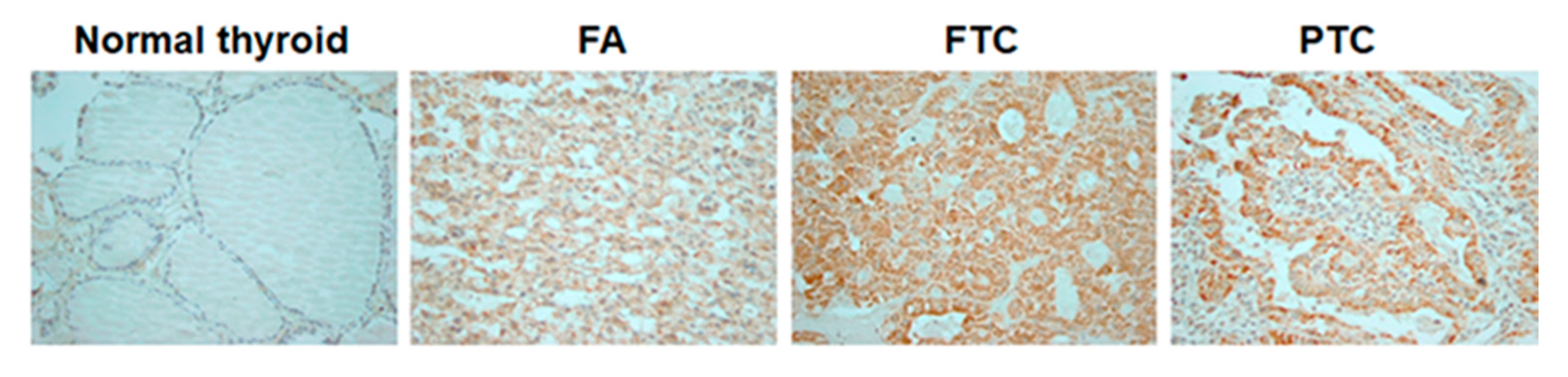 Cancers 12 02548 g001