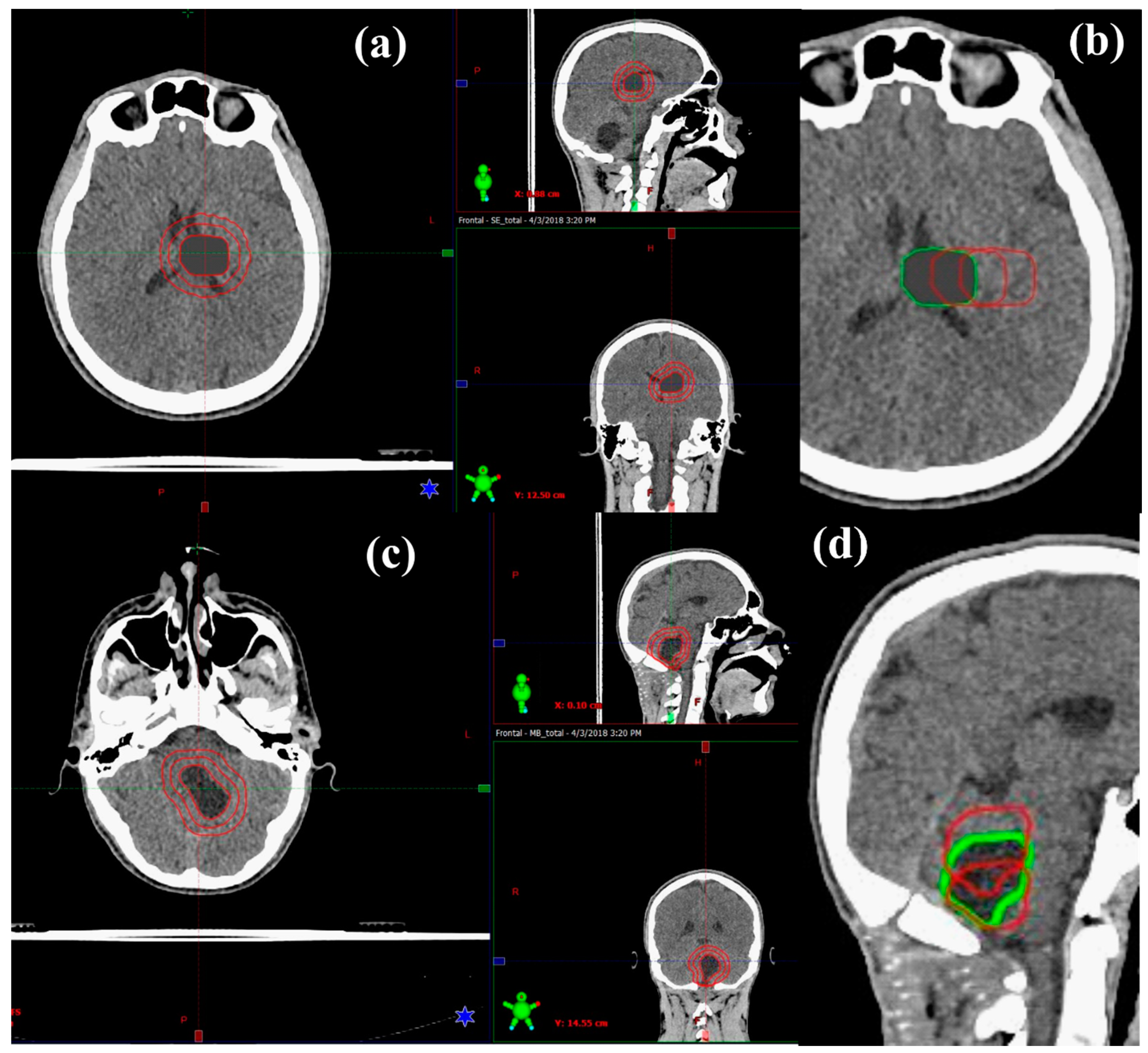 Cancers 12 02578 g001 Cancers 12 02578 g001