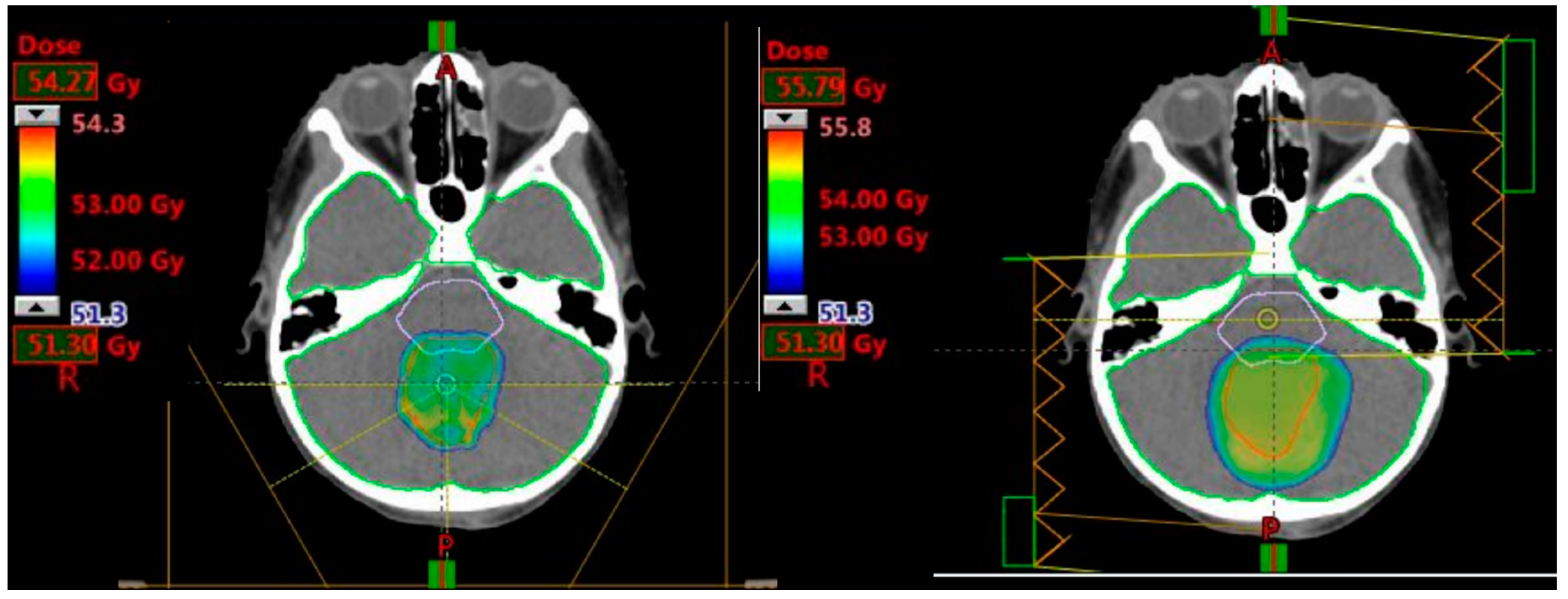 Cancers 12 02578 g004 Cancers 12 02578 g004