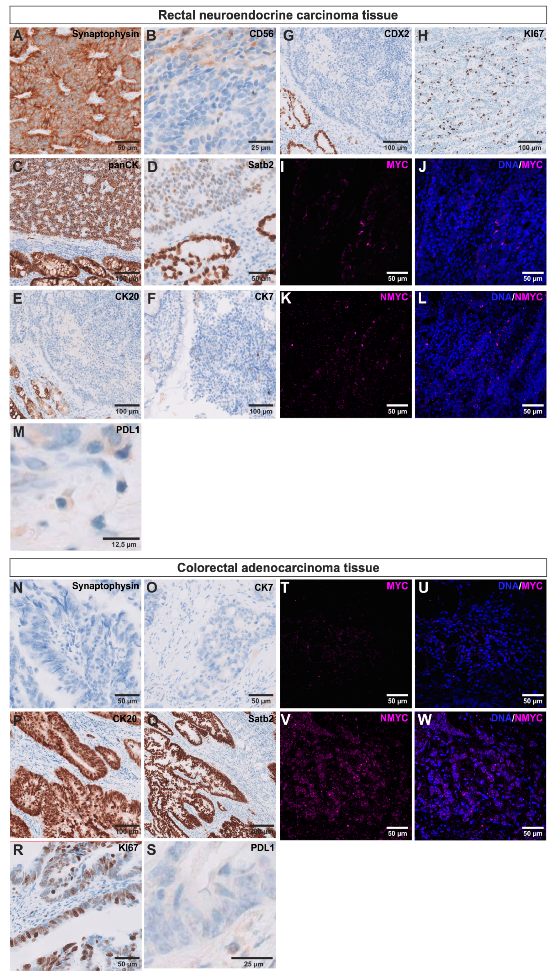 Cancers 12 02582 g002 Cancers 12 02582 g002