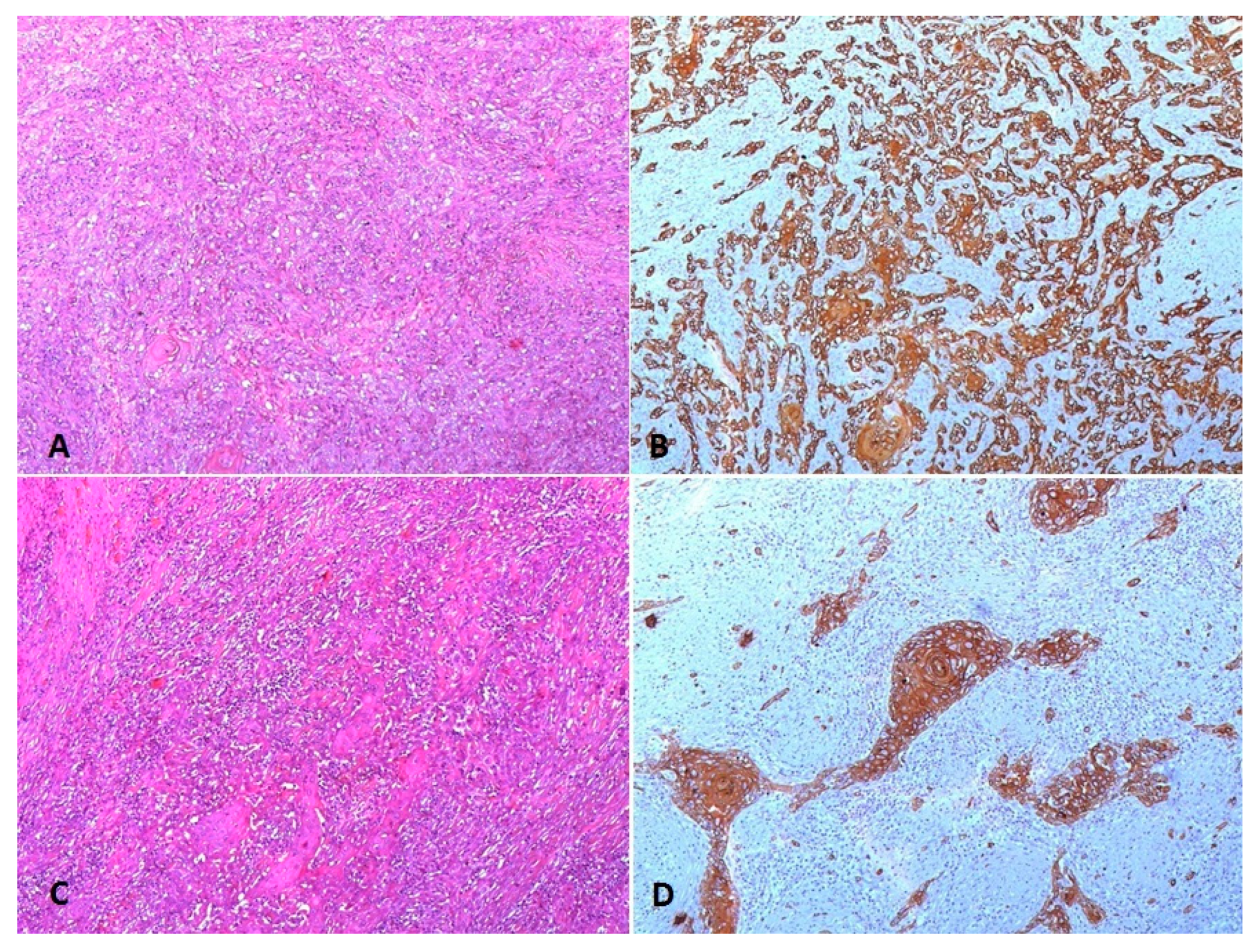 Cancers 12 02585 g002 Cancers 12 02585 g002