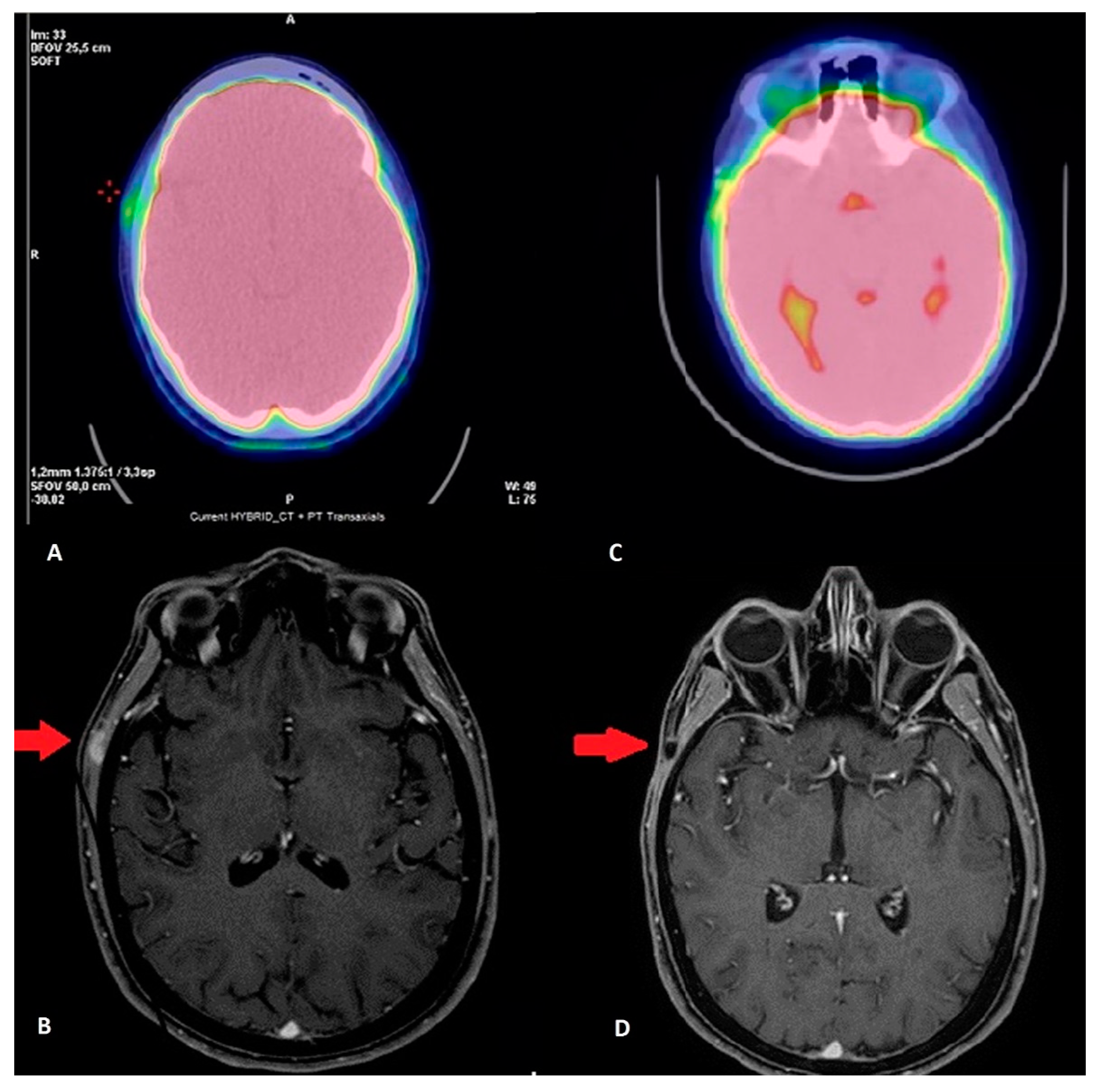Cancers 12 02585 g003 Cancers 12 02585 g003