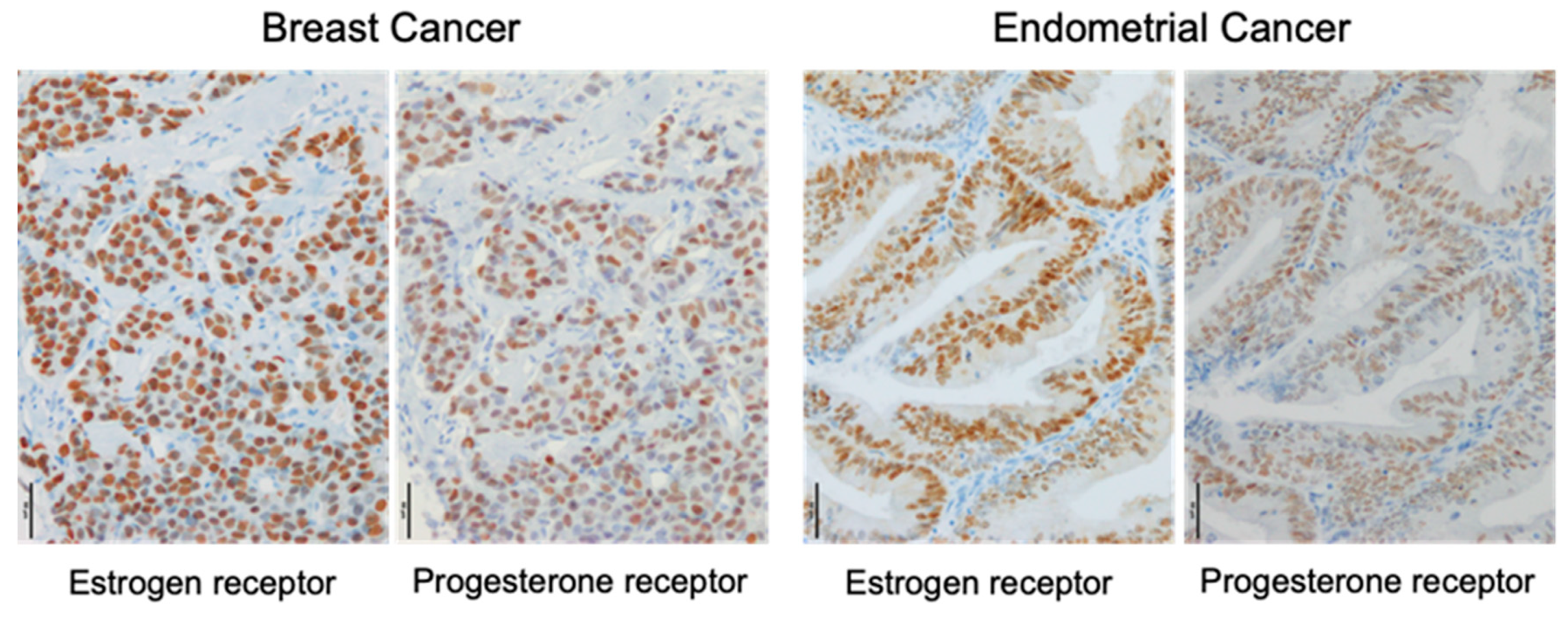 Cancers 12 02595 g001 Cancers 12 02595 g001