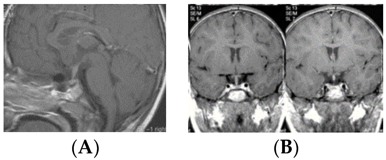 Cancers 12 02621 g006