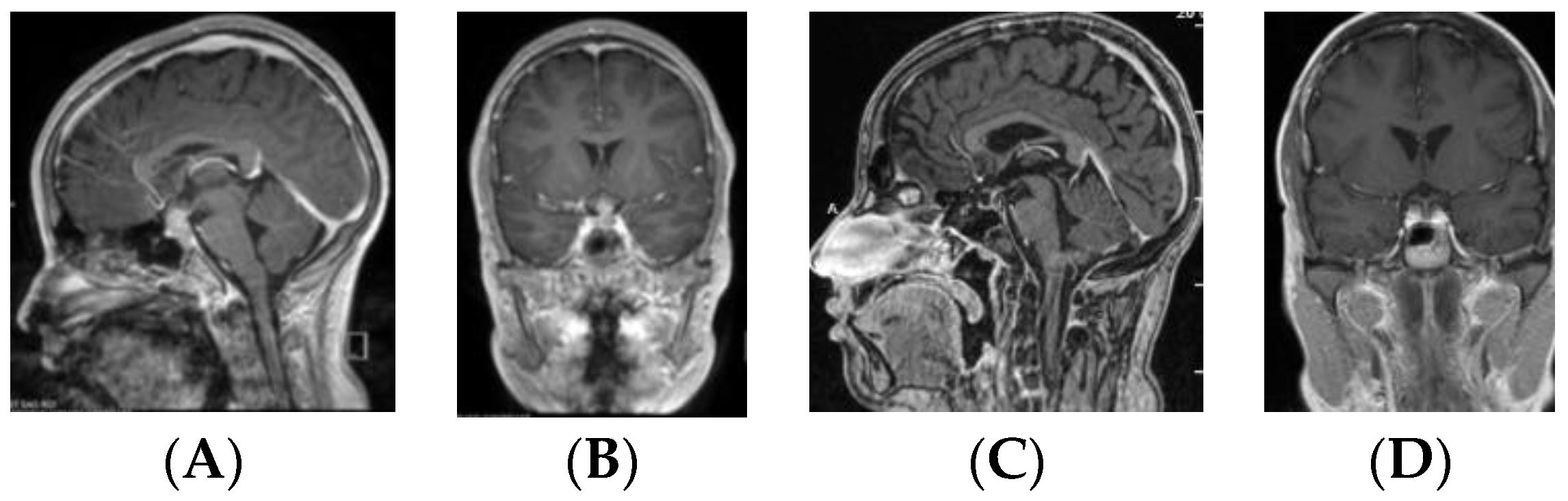 Cancers 12 02621 g007