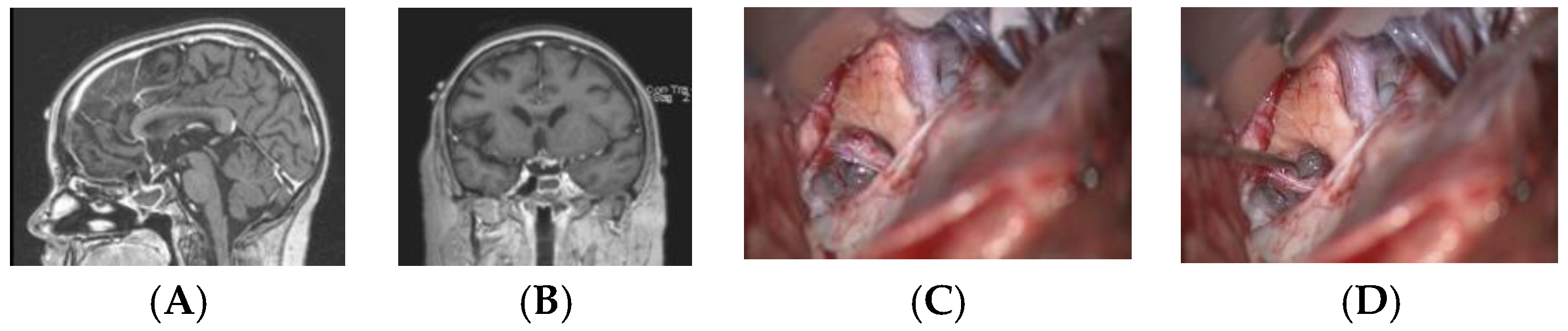 Cancers 12 02621 g008