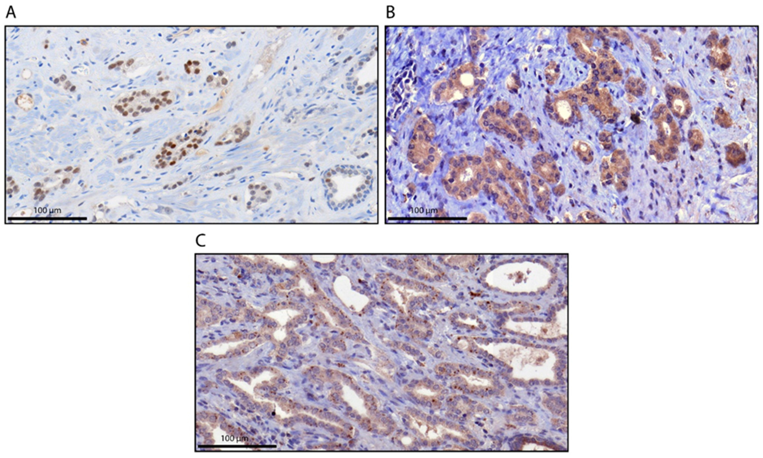 Cancers 12 02639 g001