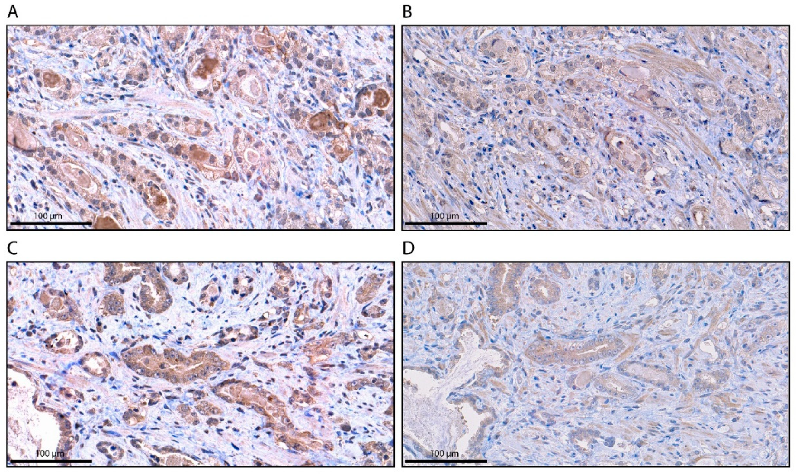 Cancers 12 02639 g002