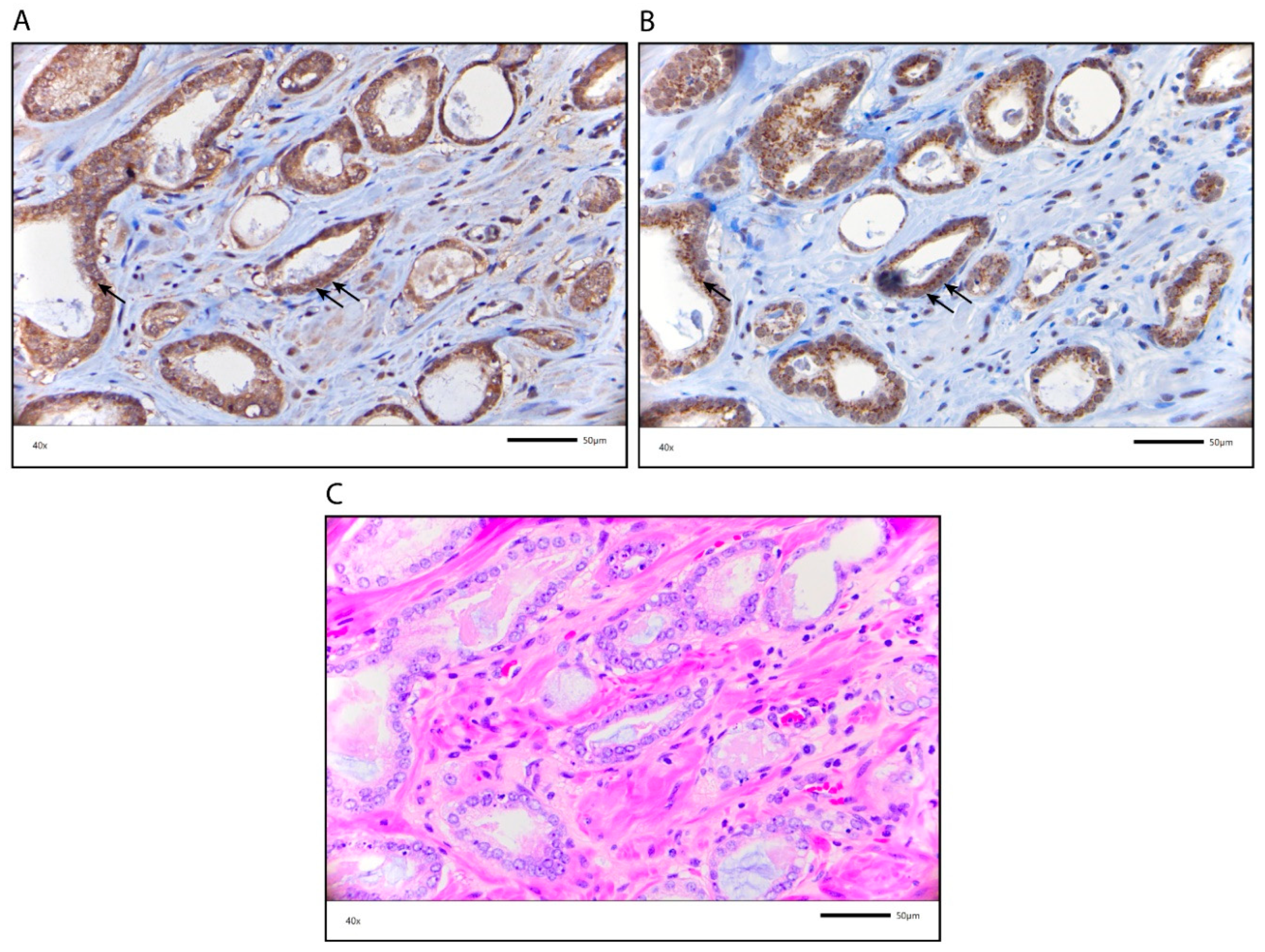 Cancers 12 02639 g005