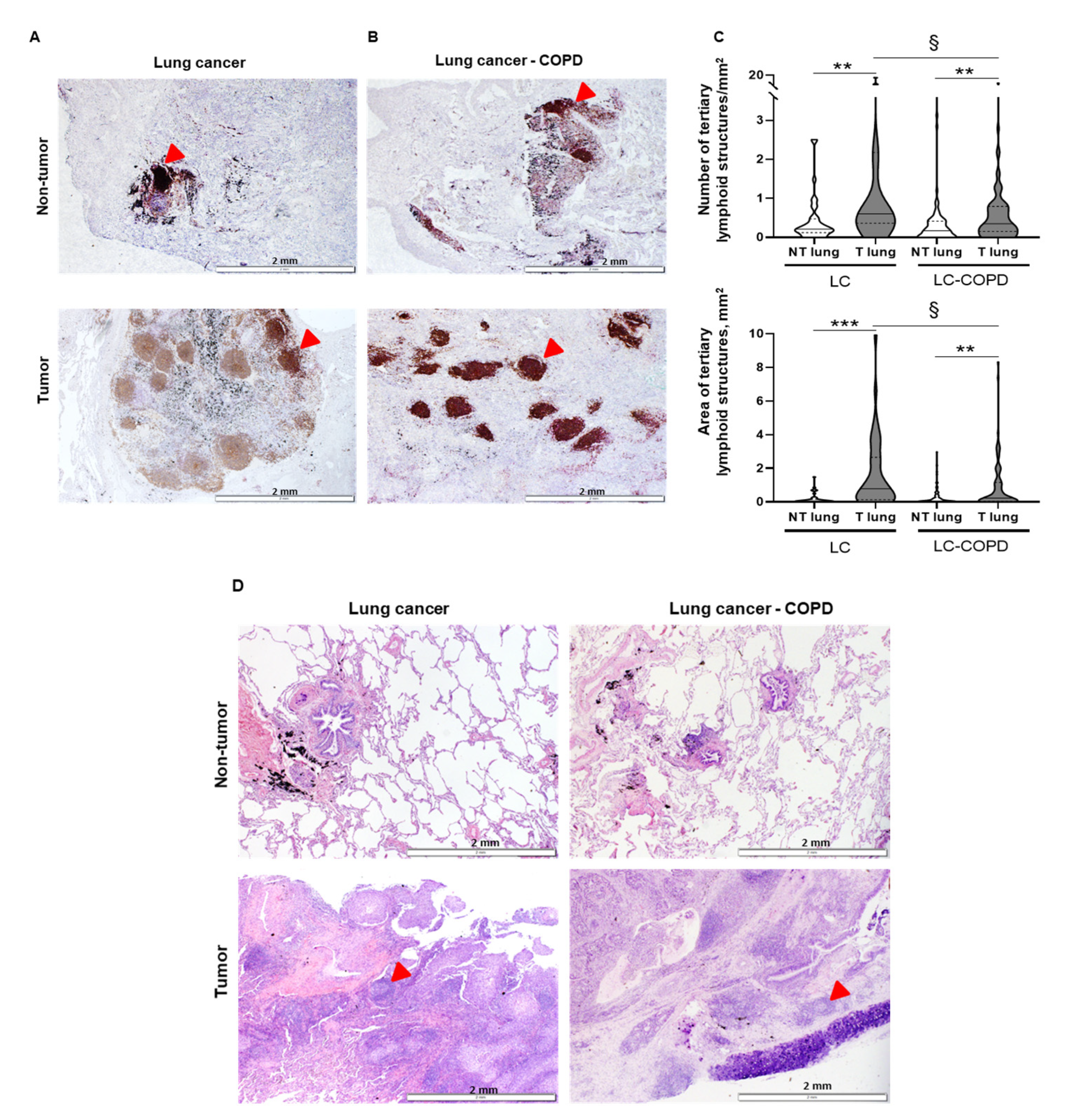 Cancers 12 02644 g001