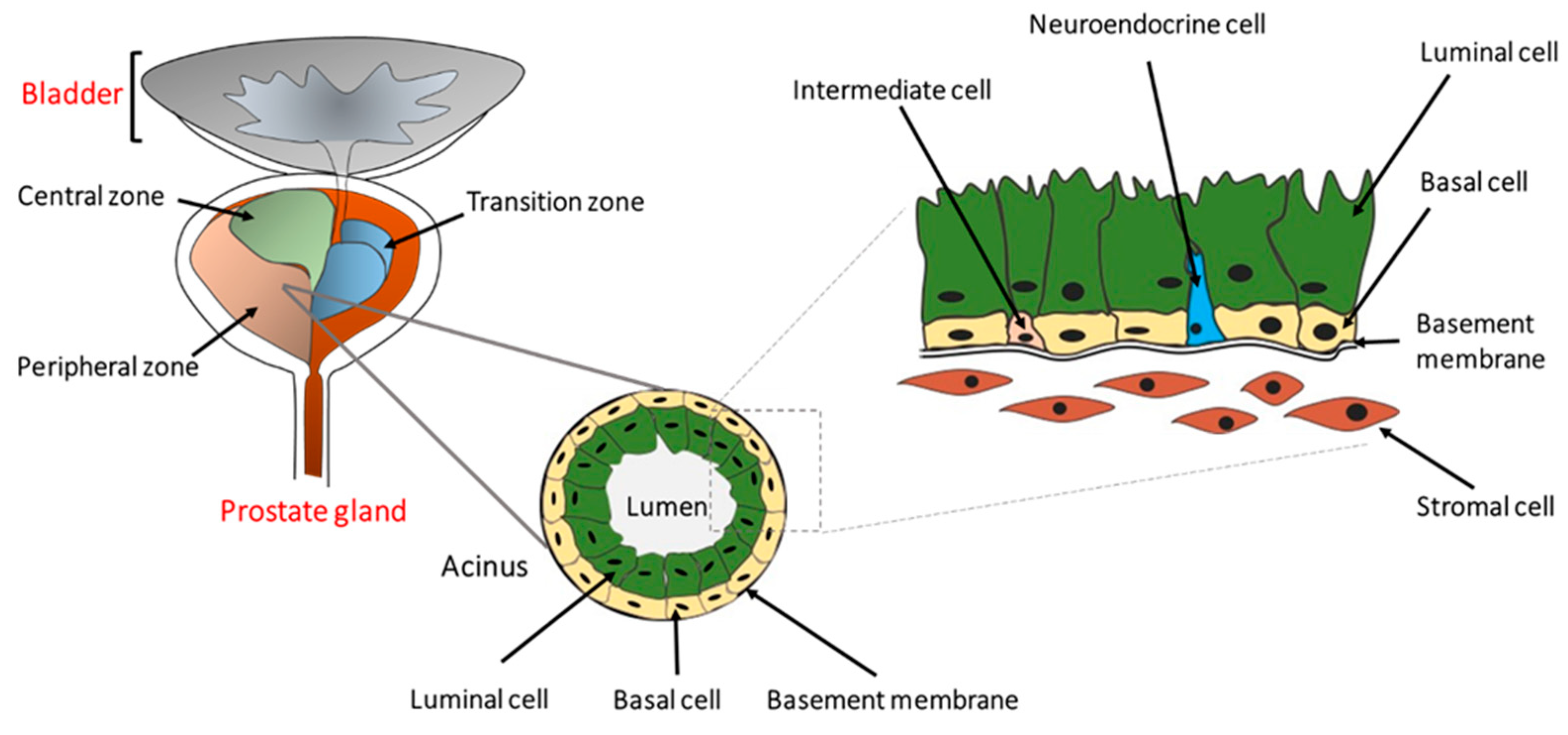 chronic bacterial prostatitis levofloxacin