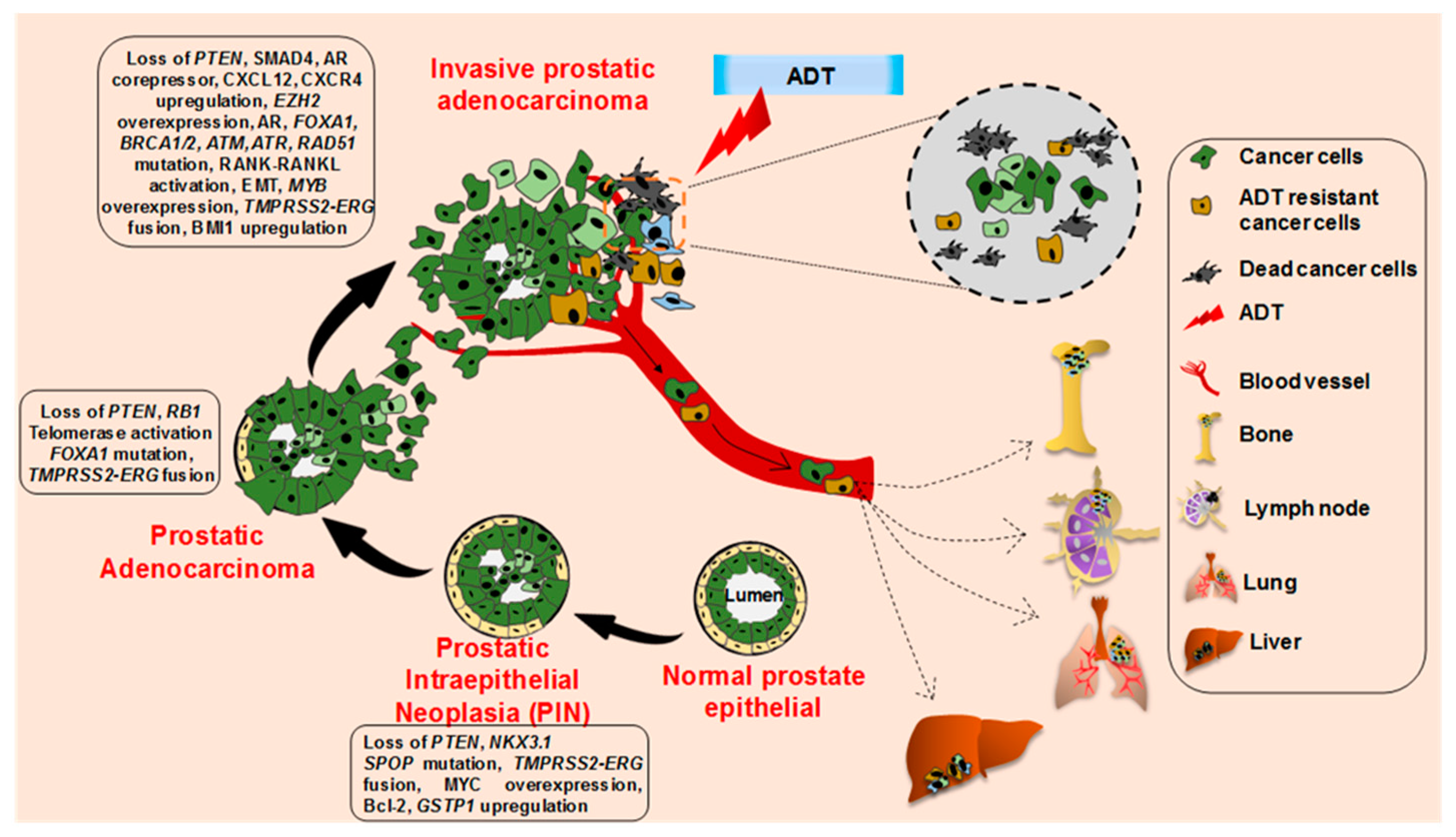 prostate capsule fares prospect ecografia prostata transrettale