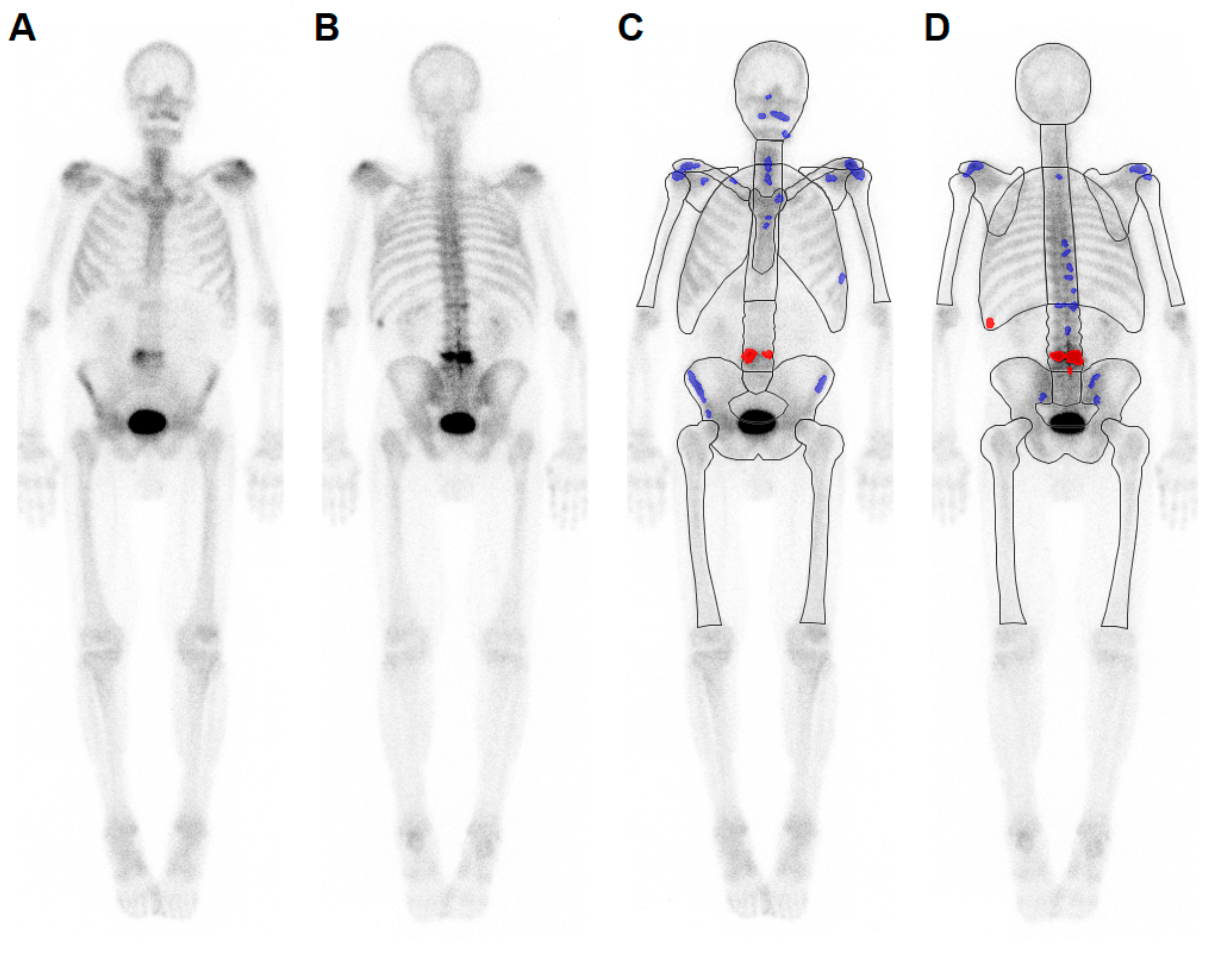Cancers 12 02654 g003