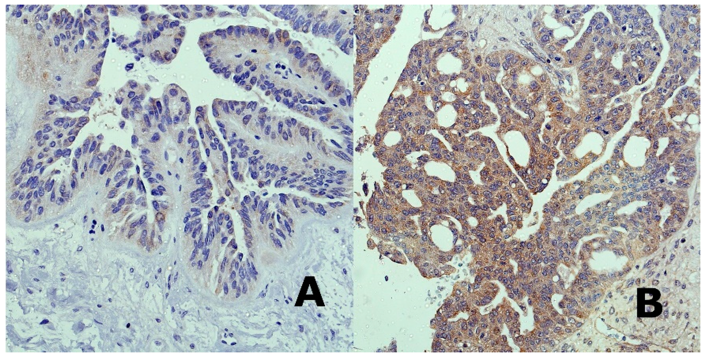 Cancers 12 02680 g001