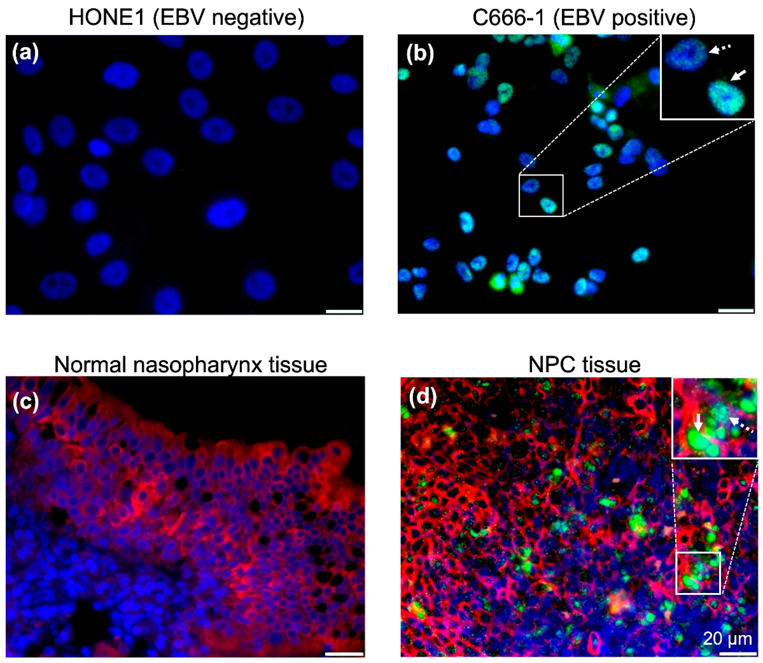Cancers 12 02722 g002