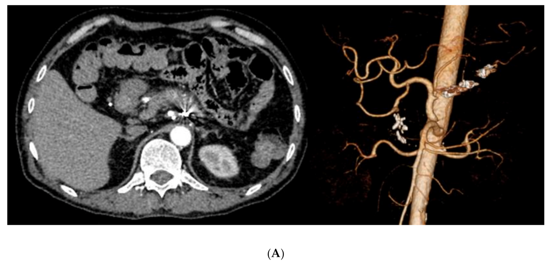 Cancers 12 02733 g001a Cancers 12 02733 g001a