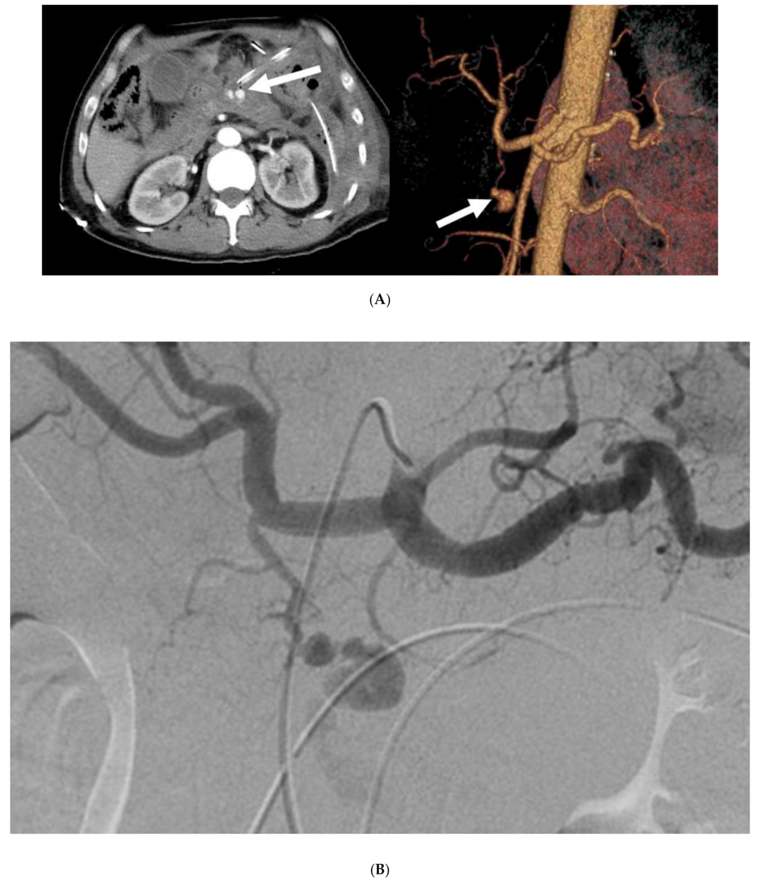 Cancers 12 02733 g002a Cancers 12 02733 g002a