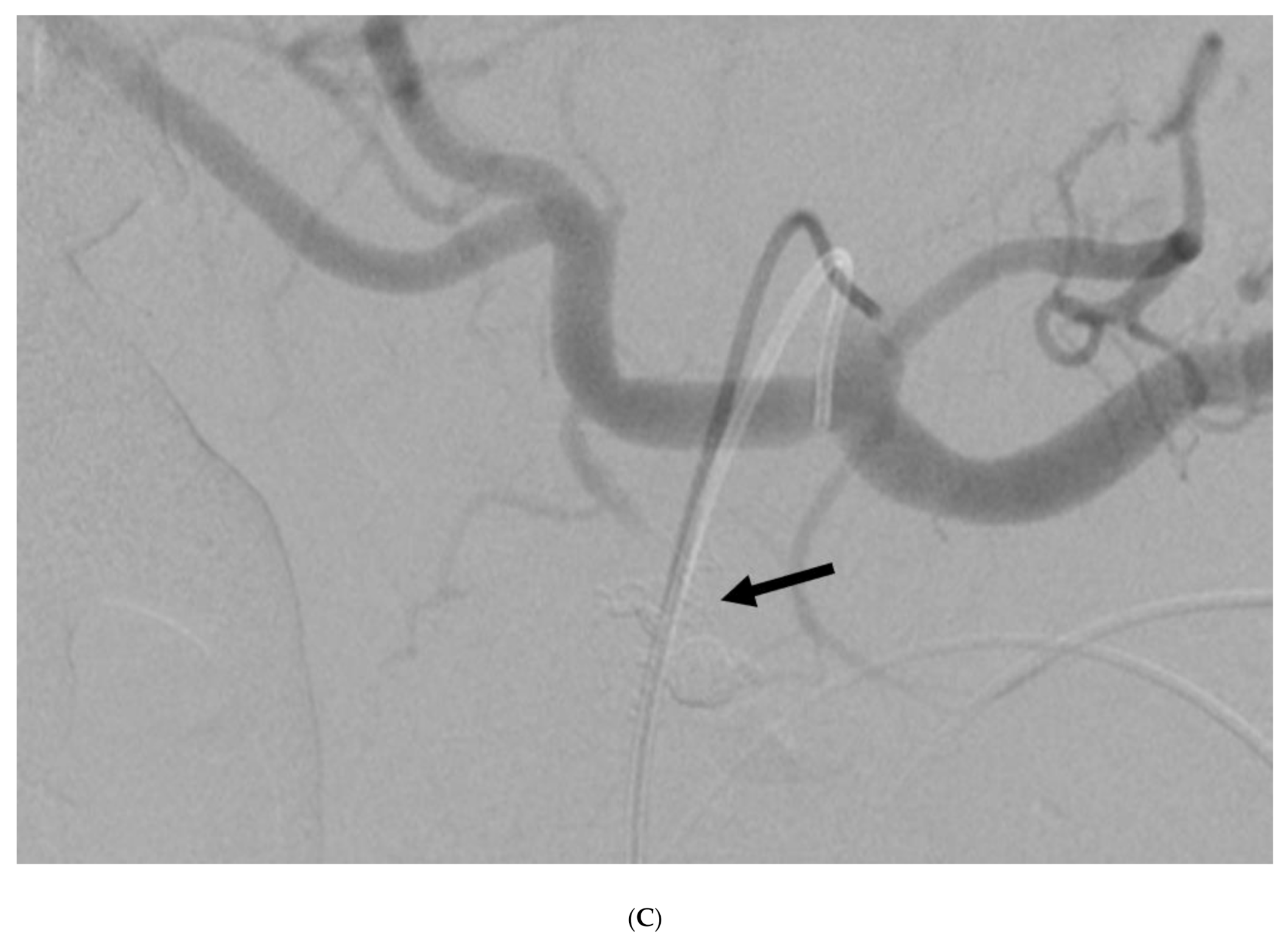 Cancers 12 02733 g002b Cancers 12 02733 g002b