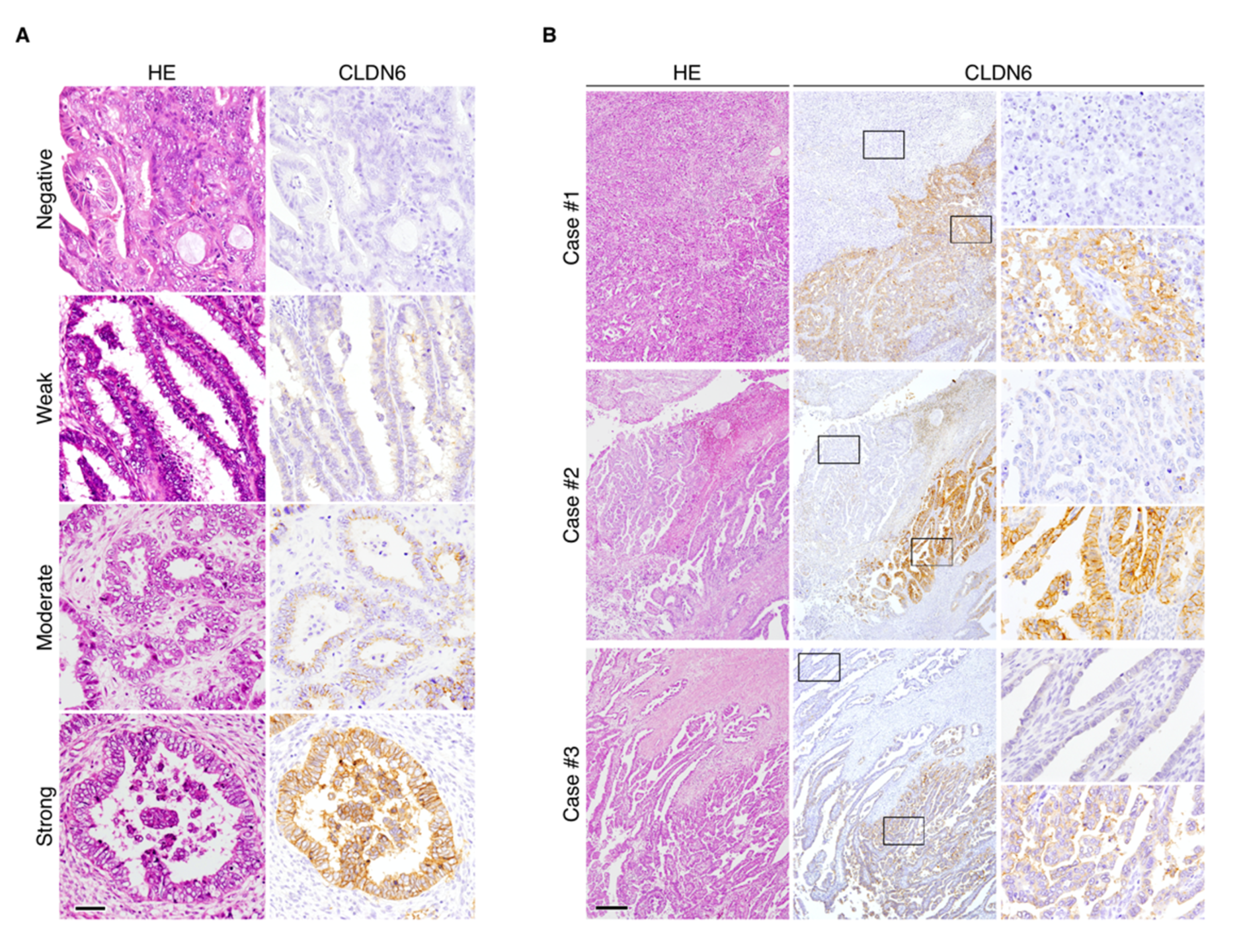 Cancers 12 02748 g002 Cancers 12 02748 g002