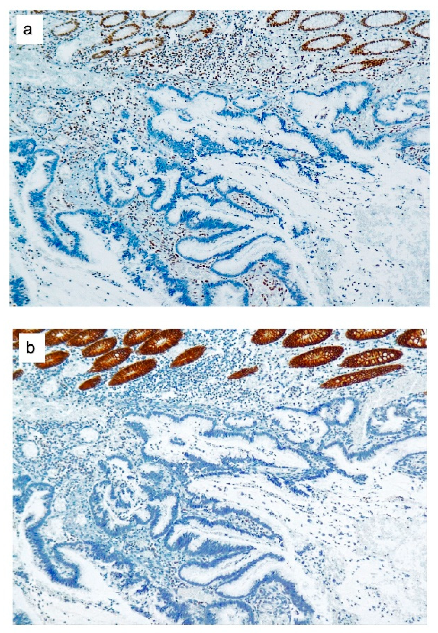 Cancers 12 02803 g001 Cancers 12 02803 g001