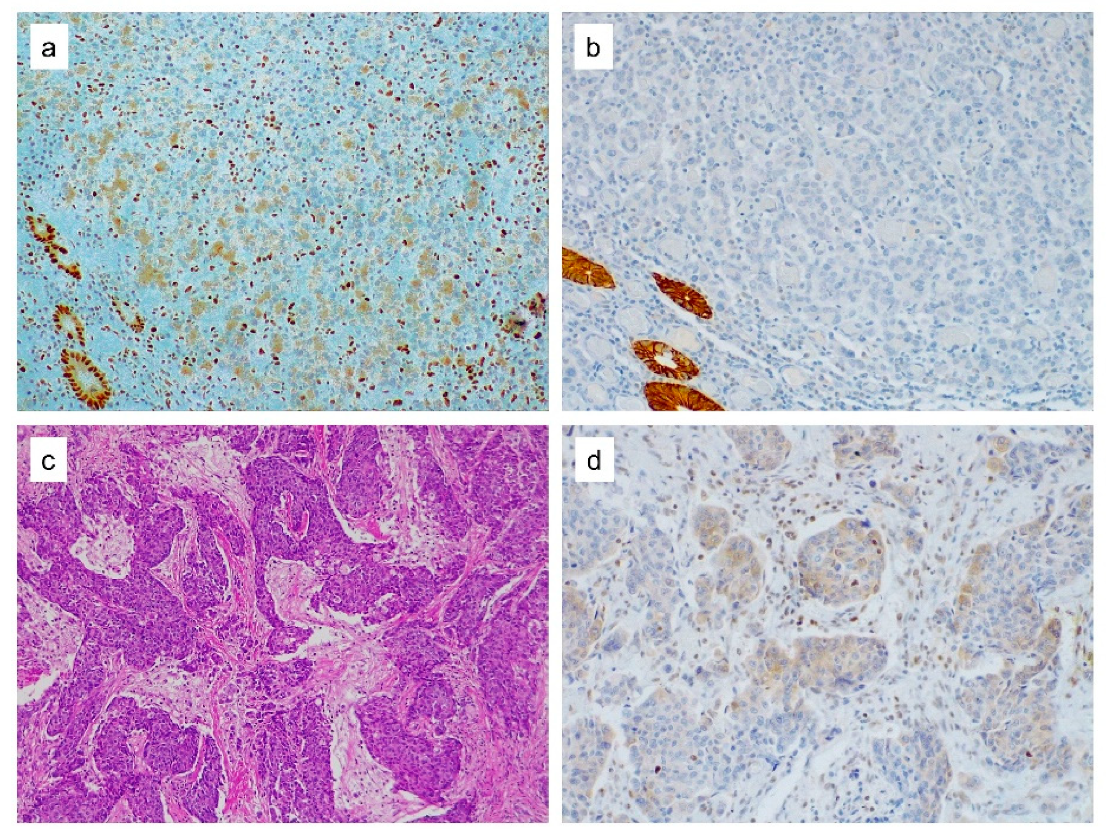 Cancers 12 02803 g002 Cancers 12 02803 g002