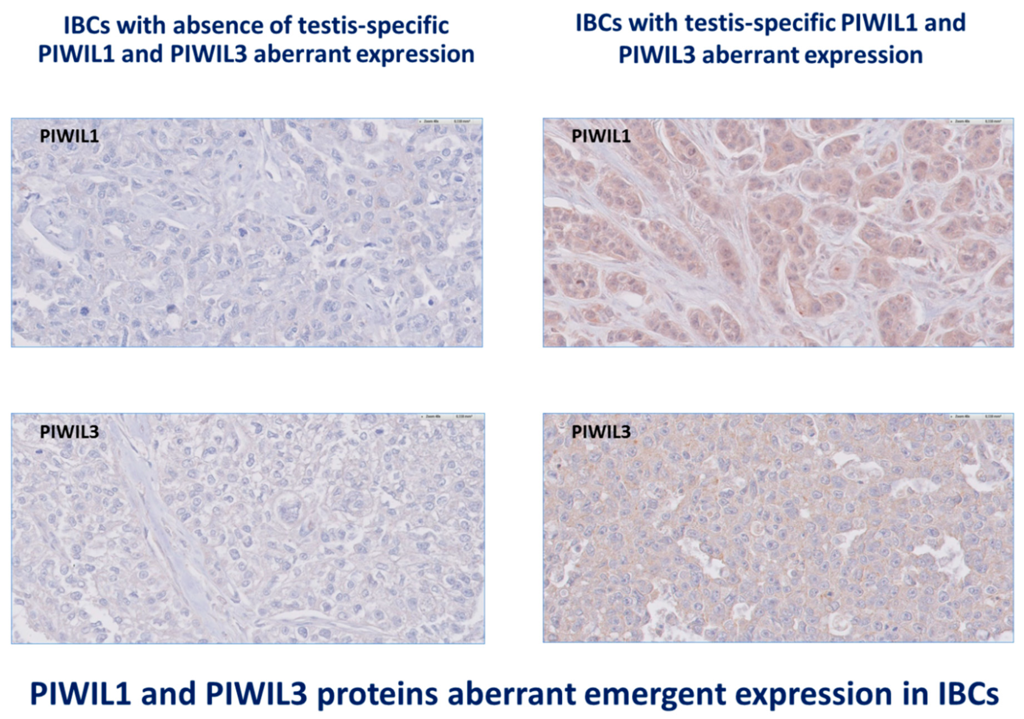 Cancers 12 02833 g001b Cancers 12 02833 g001b