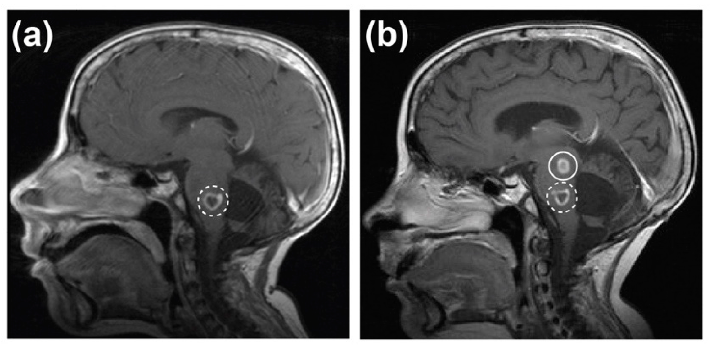 Cancers 12 02937 g002