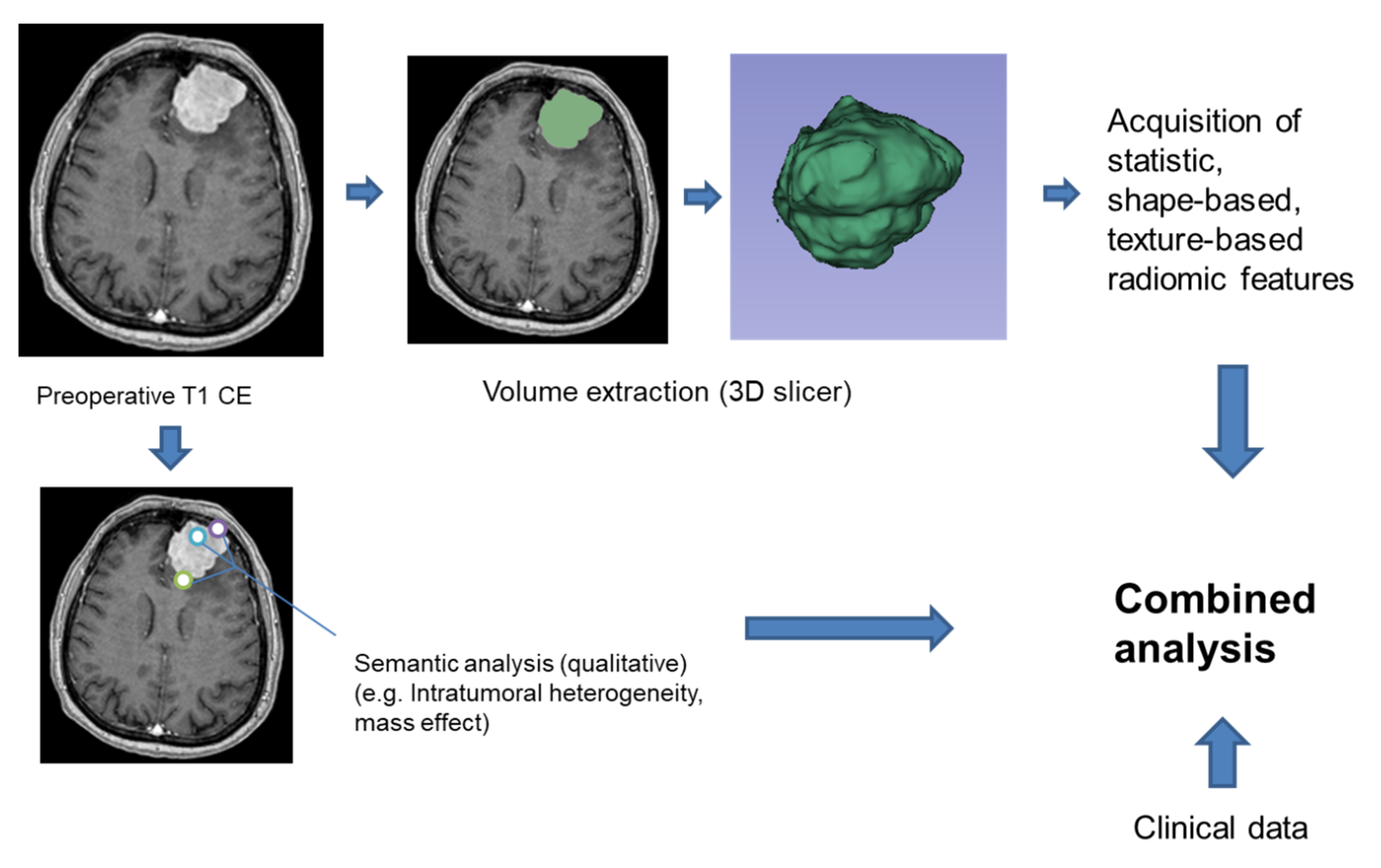 Identification of High-Risk Atypical Meningiomas According