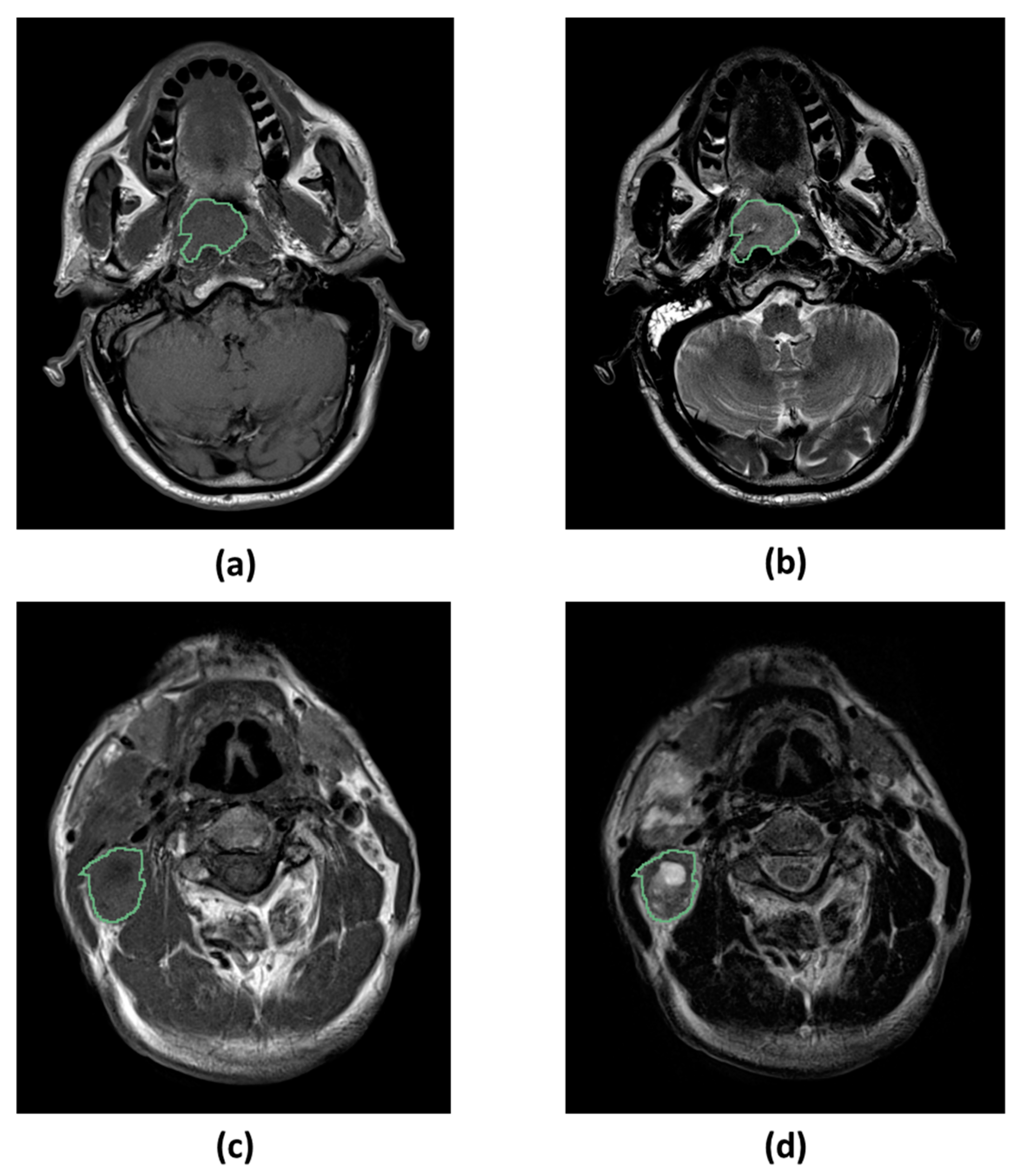 Cancers 12 02958 g006