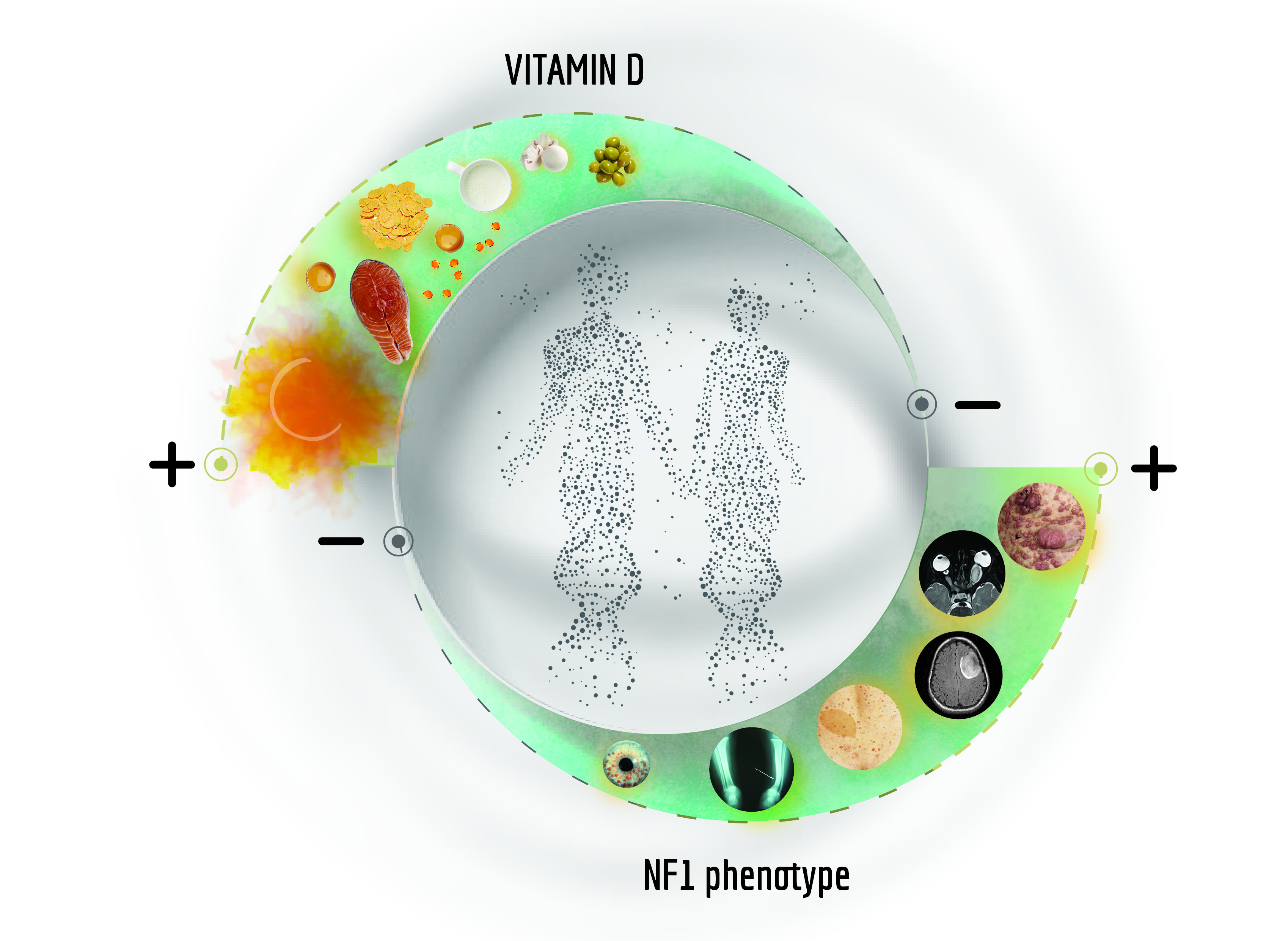 Cancers Free Full Text Understanding The Biological Activities Of Vitamin D In Type 1 Neurofibromatosis New Insights Into Disease Pathogenesis And Therapeutic Design Html