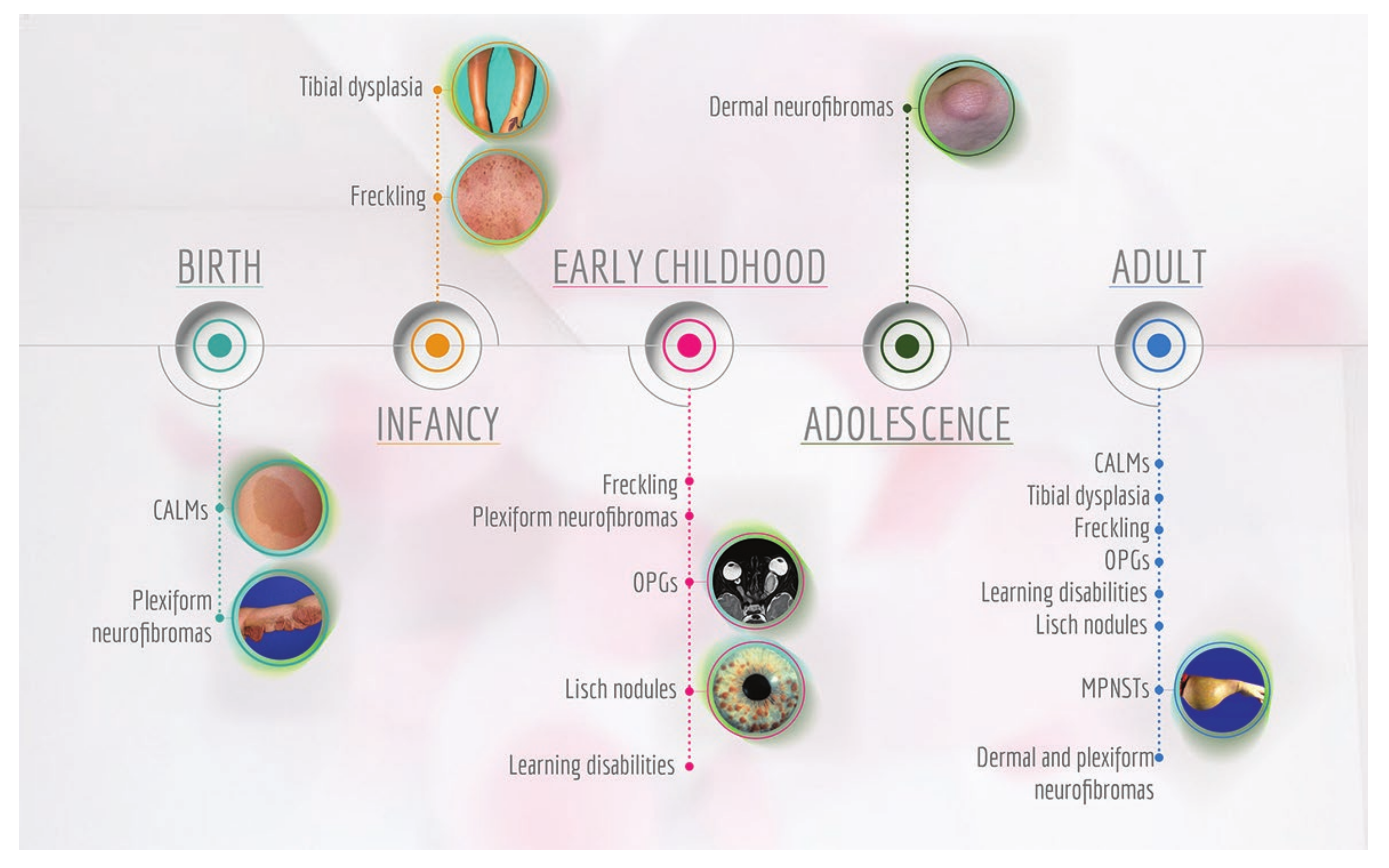 Cancers 12 02965 g004