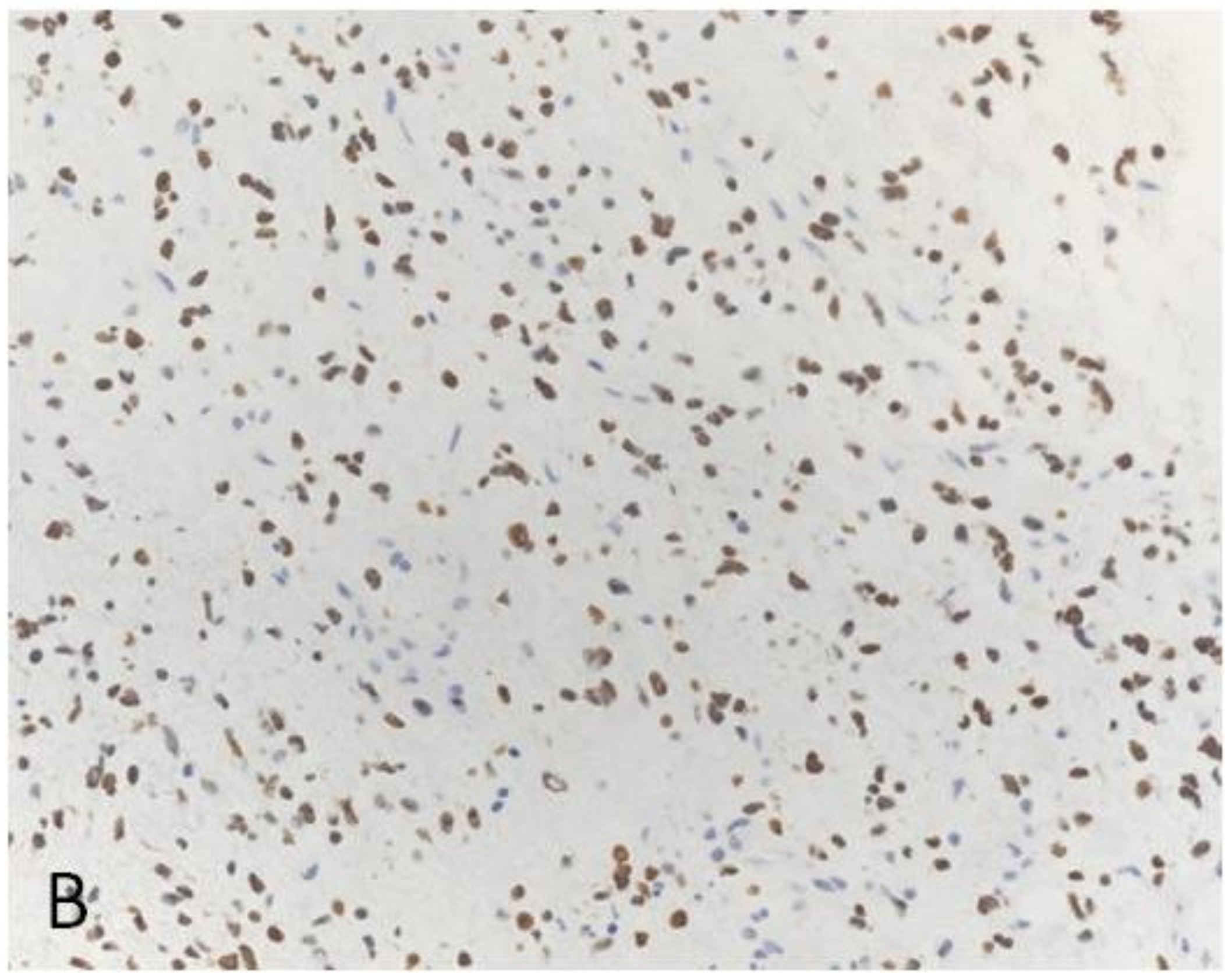 Cancers 12 03008 g002b Cancers 12 03008 g002b