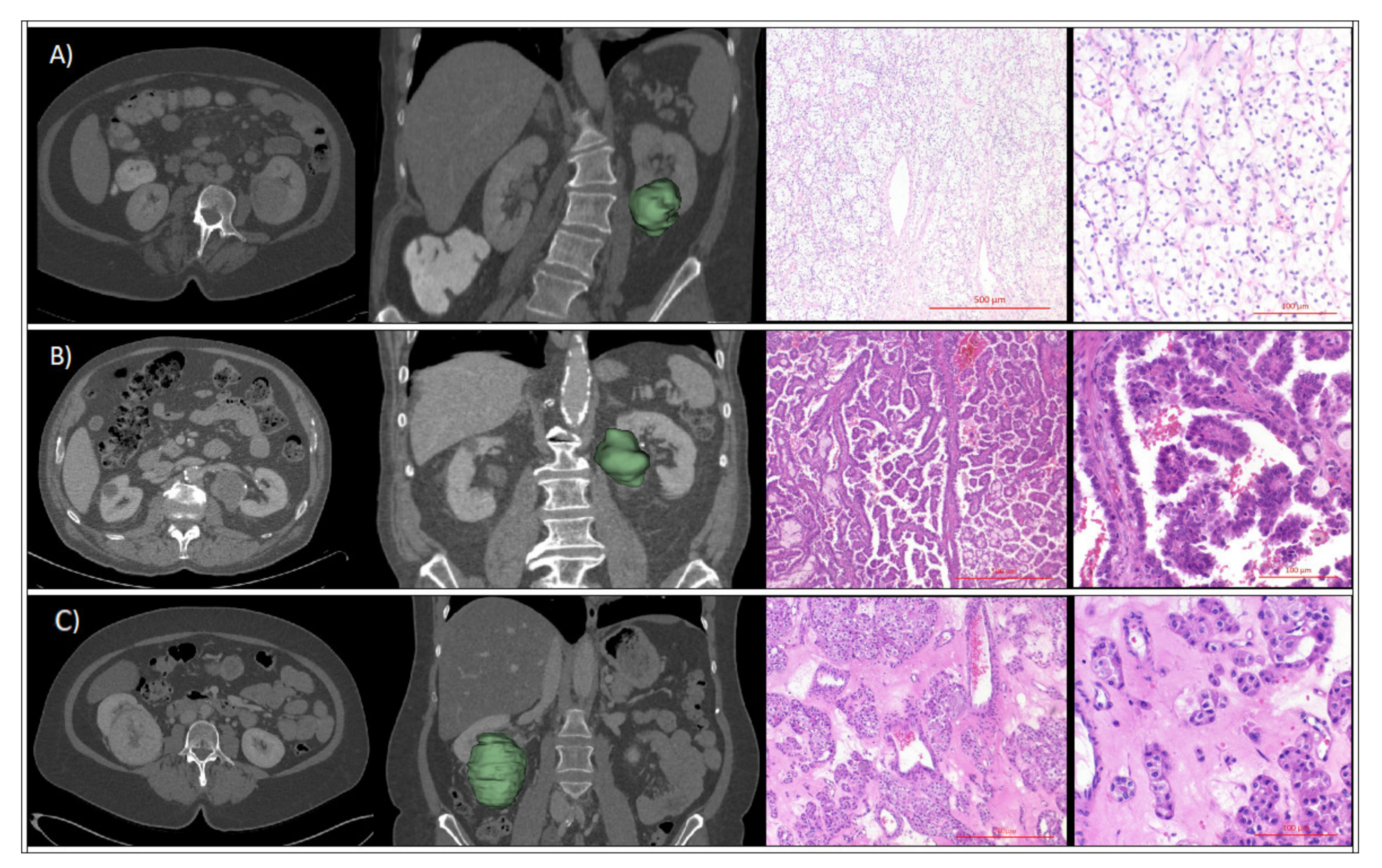 Cancers 12 03010 g002 Cancers 12 03010 g002