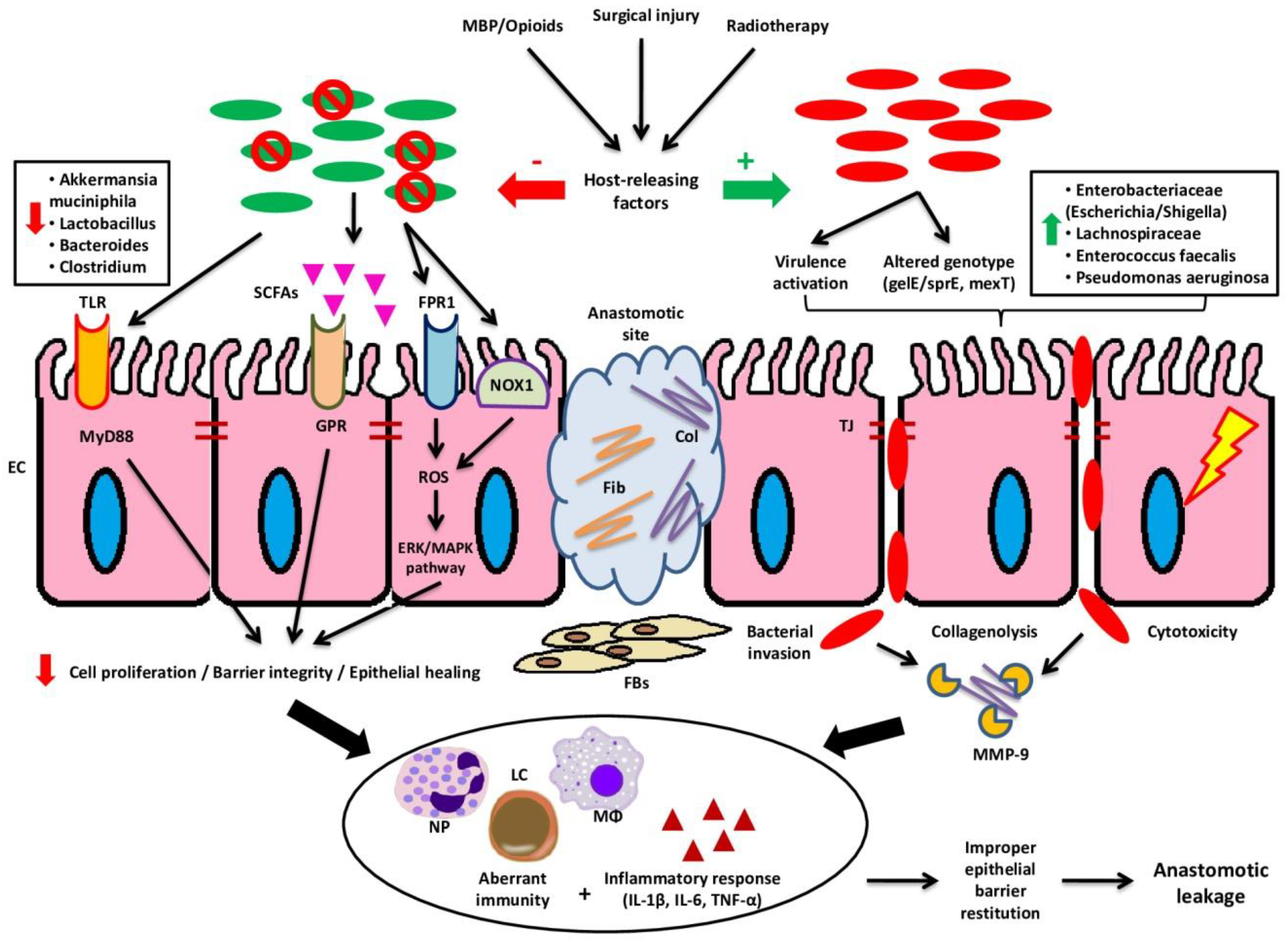 Cancers | Free Full-Text | Intestinal Microbiota in Colorectal 