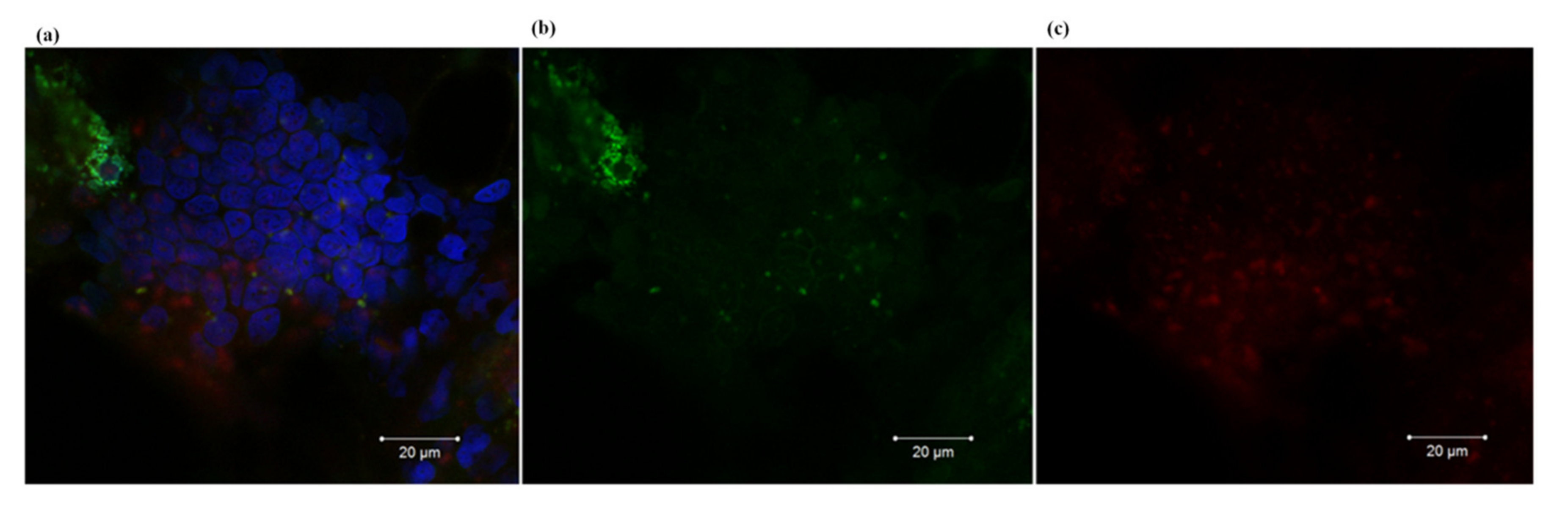 Cancers 12 03014 g004
