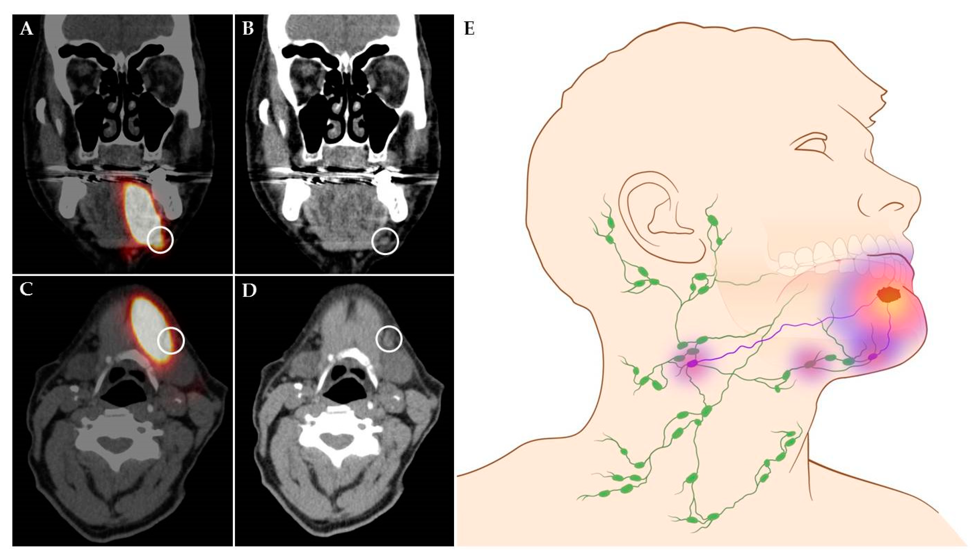 Floor Of Mouth Anatomy Pdf Free Bios Pics