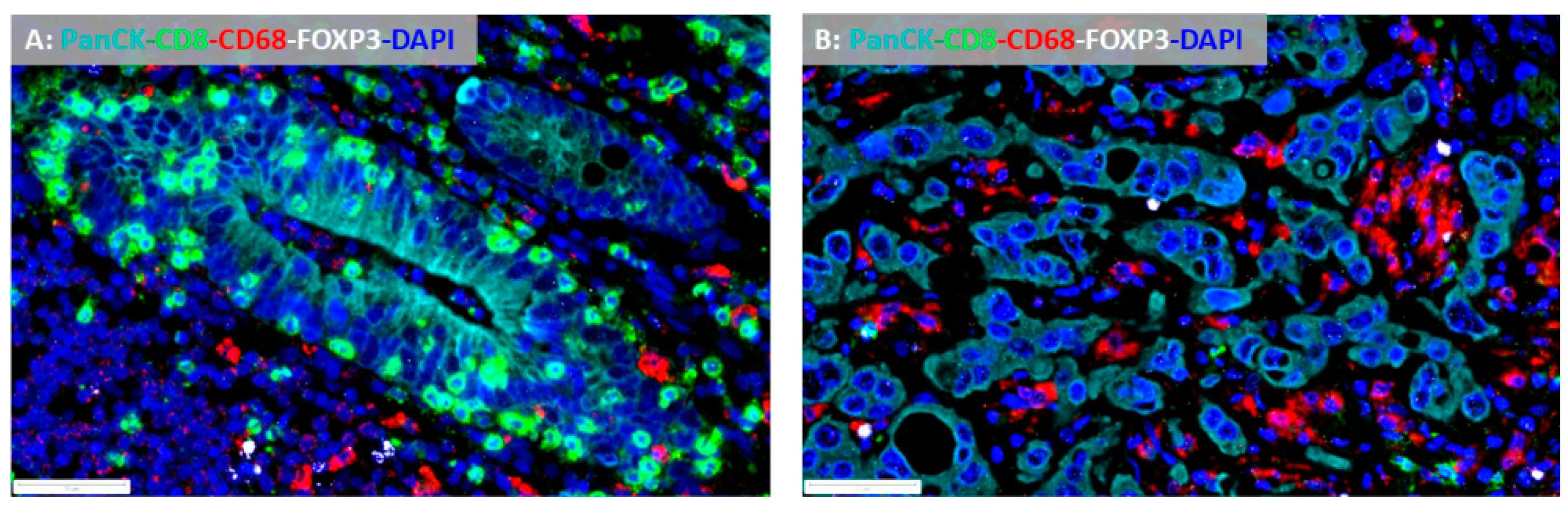 Cancers 12 03076 g001 Cancers 12 03076 g001