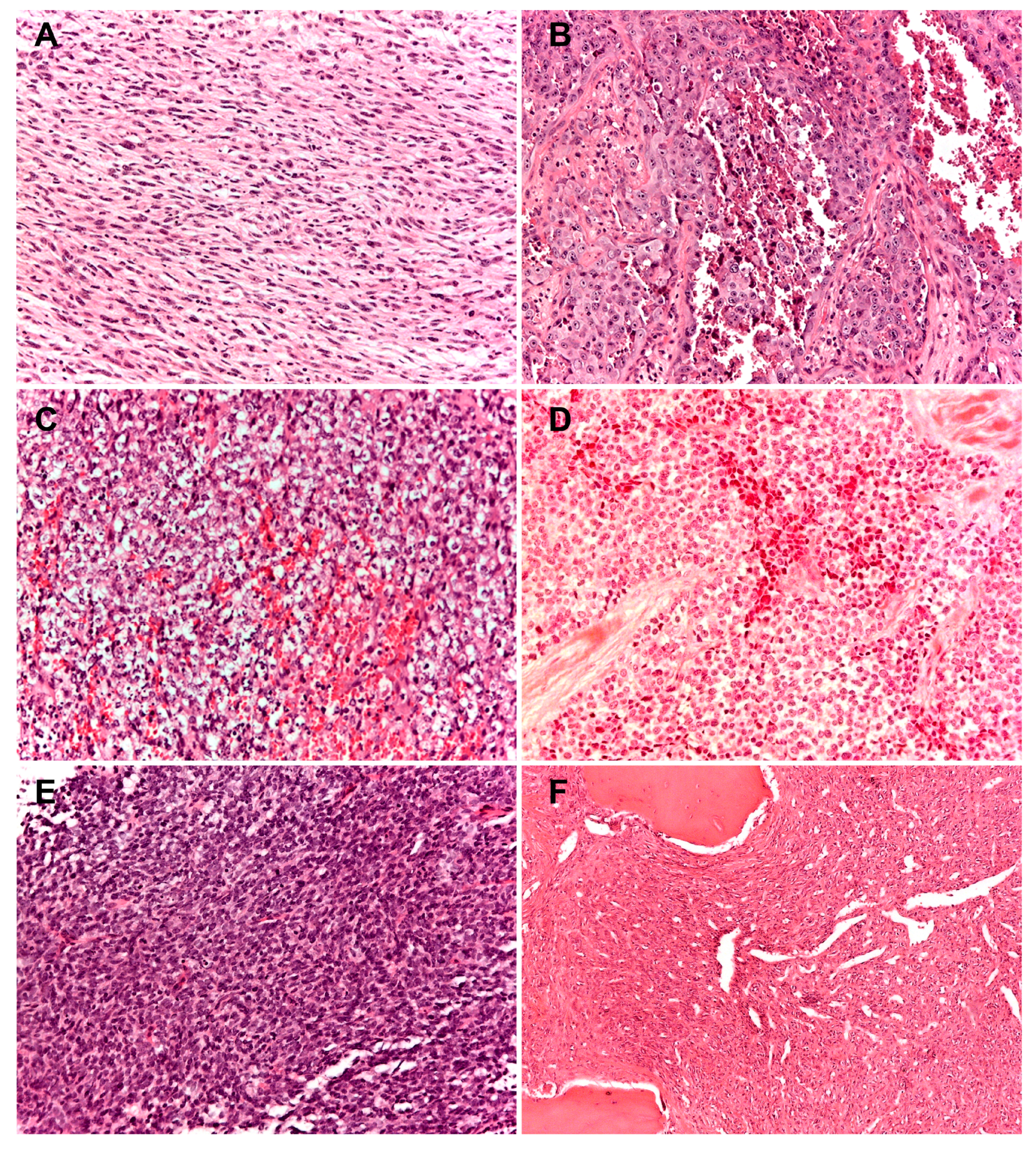 Cancers 12 03092 g002 Cancers 12 03092 g002