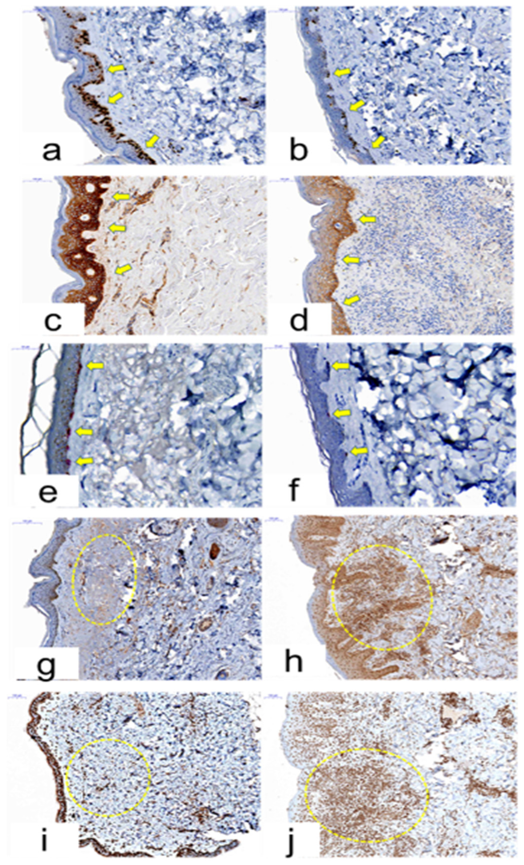 Cancers 12 03120 g006