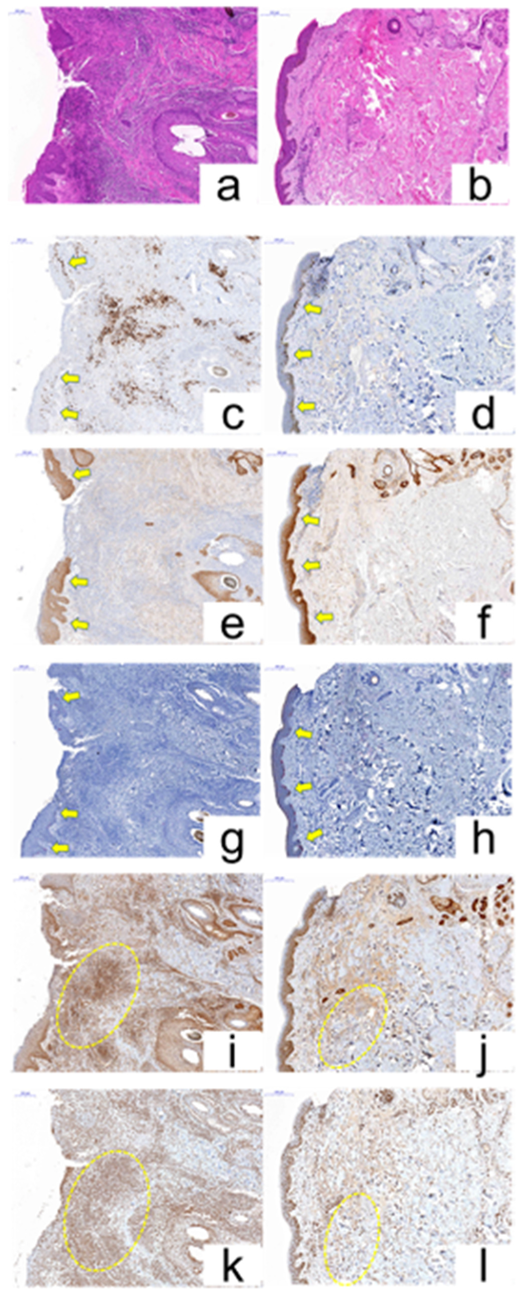 Cancers 12 03120 g007