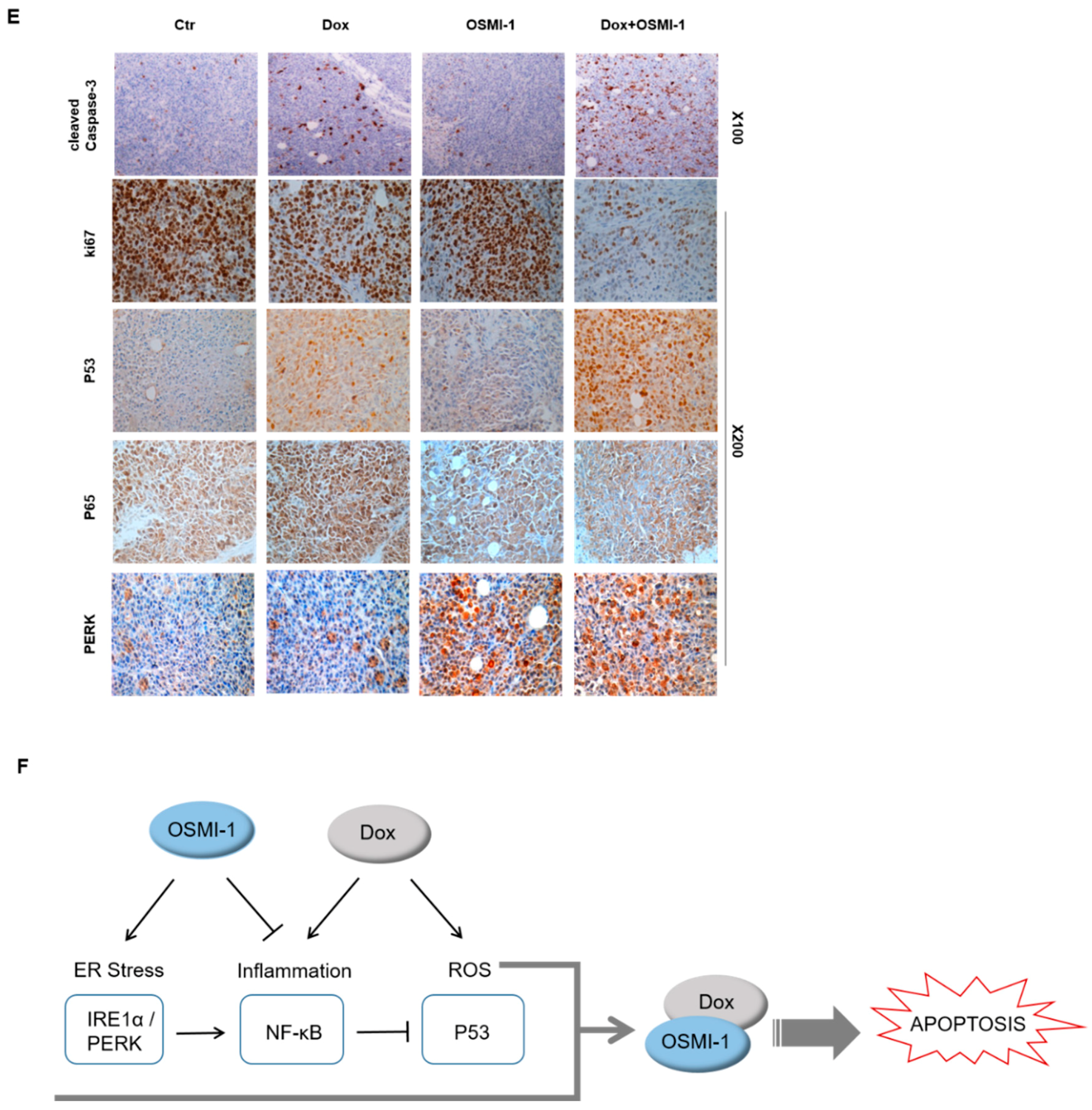 Cancers 12 03154 g005b Cancers 12 03154 g005b