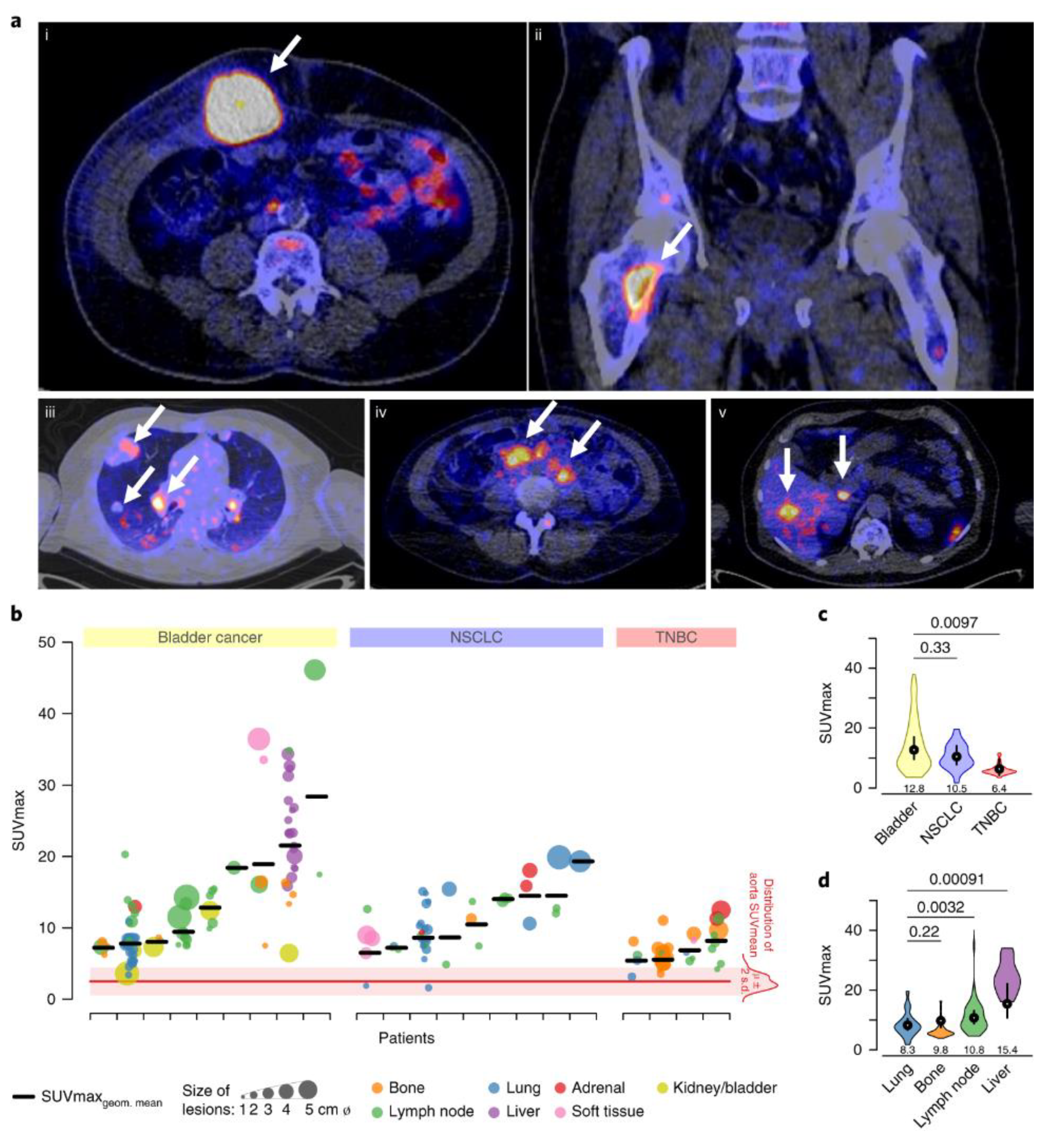 Cancers 12 03173 g002 Cancers 12 03173 g002