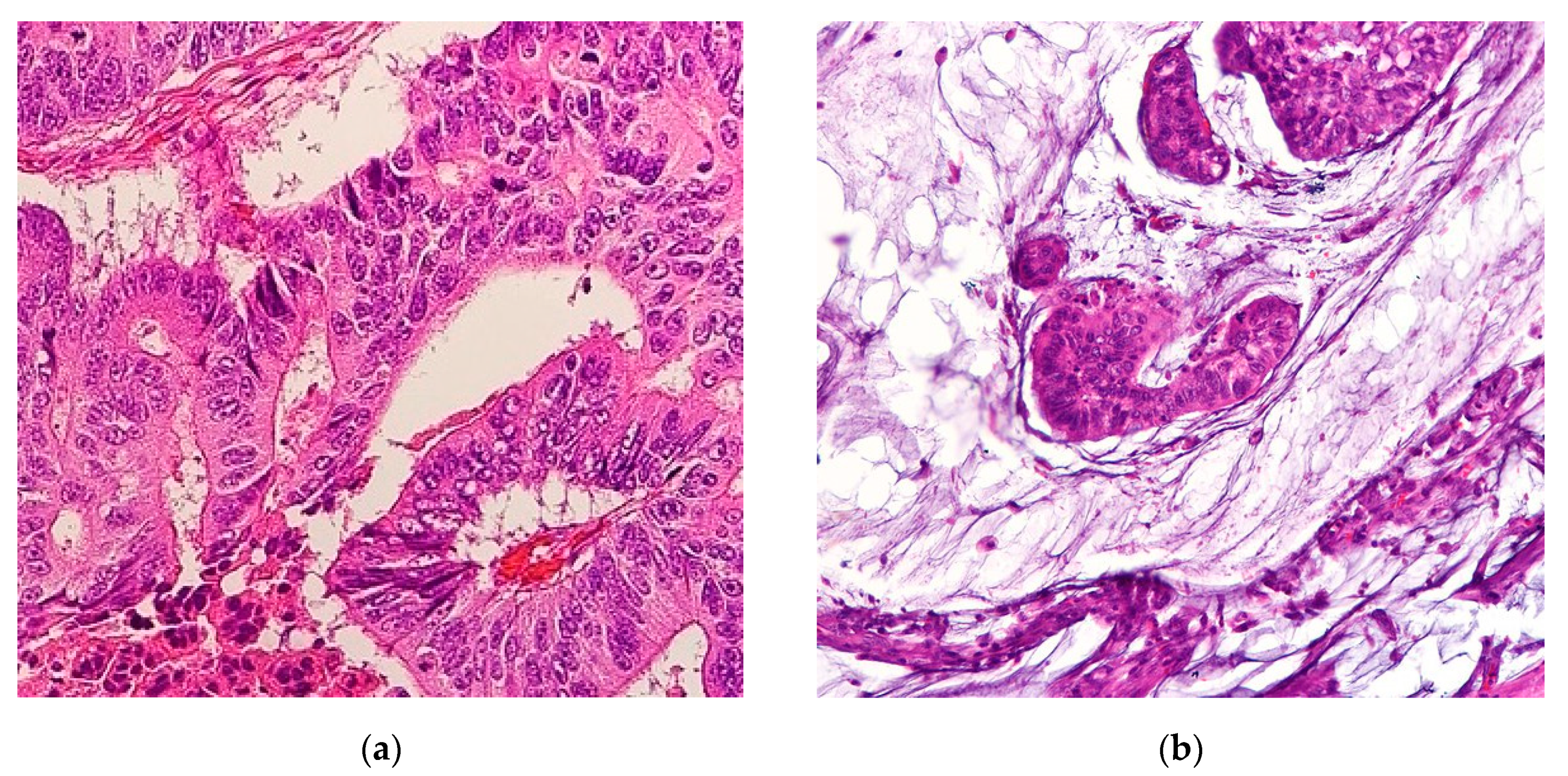 Cancers 12 03193 g001