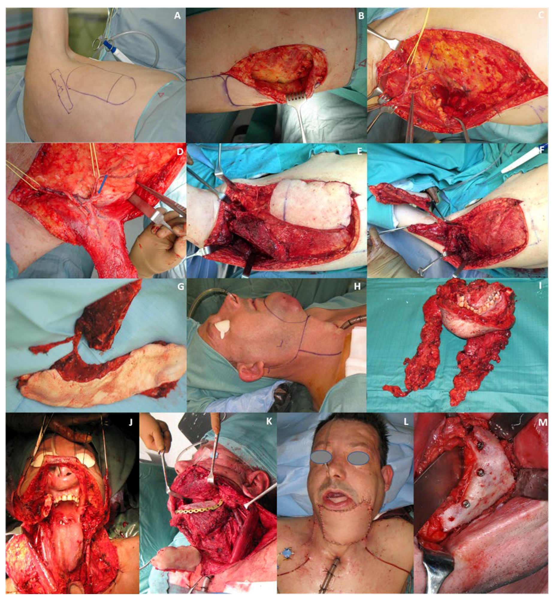 Cancers 12 03198 g003 Cancers 12 03198 g003