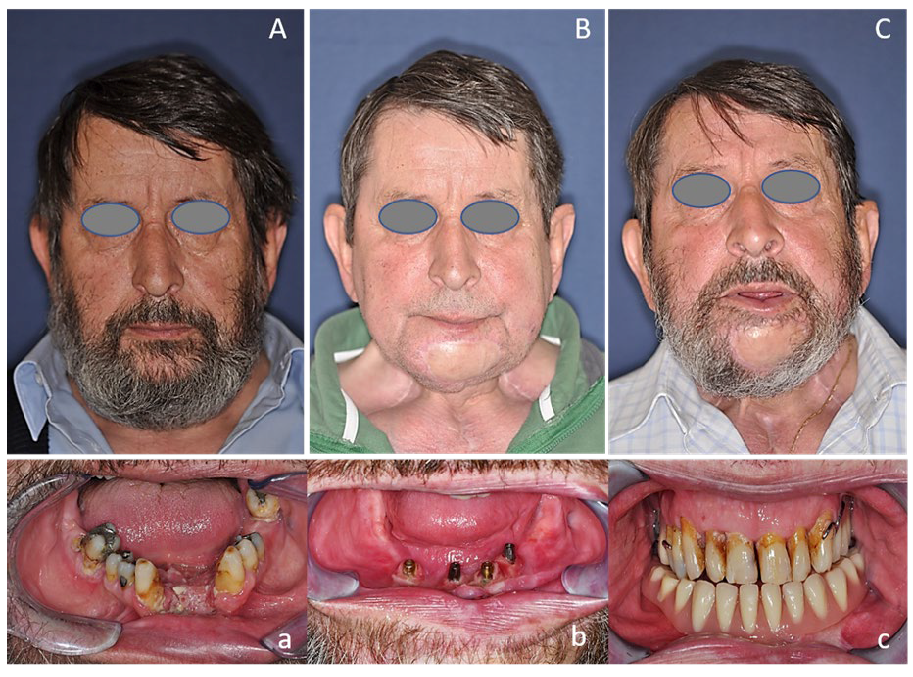 Cancers 12 03198 g004 Cancers 12 03198 g004